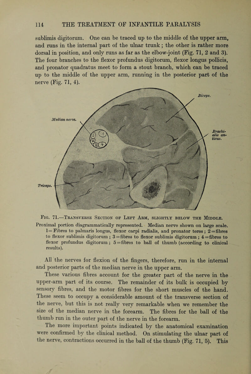 sublimis digitorum. One can be traced up to the middle of the upper arm, and runs in the internal part of the ulnar trunk; the other is rather more dorsal in position, and only runs as far as the elbow-joint (Fig. 71, 2 and 3). The four branches to the flexor profundus digitorum, flexor longus pollicis, and pronator quadratus meet to form a stout branch, which can be traced up to the middle of the upper arm, running in the posterior part of the nerve (Fig. 71, 4). Fig. 71.—Transverse Section of Left Arm, slightly below the Middle. Proximal portion diagrammatically represented. Median nerve shown on large scale. 1= Fibres to palmaris longus, flexor carpi radialis, and pronator teres; 2= fibres to flexor sublimis digitorum ; 3= fibres to flexor sublimis digitorum ; 4=fibres to flexor profundus digitorum; 5= fibres to ball of thumb (according to clinical results). All the nerves for flexion of the fingers, therefore, run in the internal and posterior parts of the median nerve in the upper arm. These various fibres account for the greater part of the nerve in the upper-arm part of its course. The remainder of its bulk is occupied by sensory fibres, and the motor fibres for the short muscles of the hand. These seem to occupy a considerable amount of the transverse section of the nerve, but this is not really very remarkable when we remember the size of the median nerve in the forearm. The fibres for the ball of the thumb run in the outer part of the nerve in the forearm. The more important points indicated by the anatomical examination were confirmed by the clinical method. On stimulating the ulnar part of the nerve, contractions occurred in the ball of the thumb (Fig. 71, 5). This