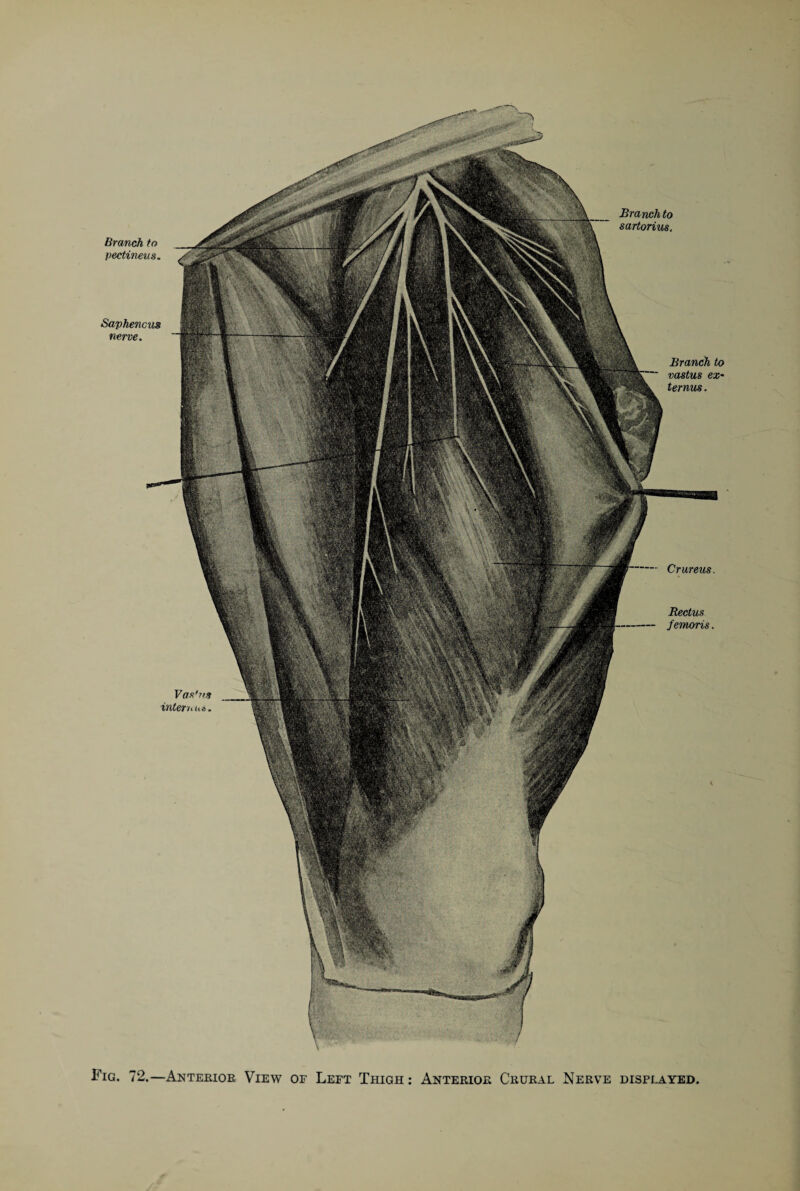 Branch to pectineus. Saphencus nerve. Branch to sartorius. Crureus. Rectus femoris. V as'? is intern ua. Branch to vastus ex- ternus. Fig. 72.—Anterior View or Left Thigh: Anterior Crural Nerve displayed