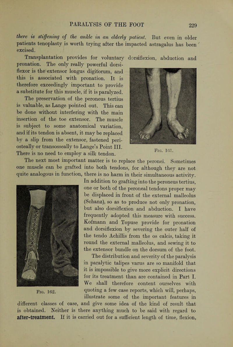 there is stiffening of the ankle in an elderly patient. But even in older patients tenoplasty is worth trying after the impacted astragalus has been / excised. Transplantation provides for voluntary dorsiflexion, abduction and pronation. The only really powerful dorsi- flexor is the' extensor longus digitorum, and this is associated with pronation. It is therefore exceedingly important to provide a substitute for this muscle, if it is paralyzed. The preservation of the peroneus tertius is valuable, as Lange pointed out. This can be done without interfering with the main insertion of the toe extensor. The muscle is subject to some anatomical variation, and if its tendon is absent, it may be replaced by a slip from the extensor, fastened peri- osteally or transosseally to Lange’s Point III. There is no need to employ a silk tendon. The next most important matter is to replace the peronei. Sometimes one muscle can be grafted into both tendons, for although they are not quite analogous in function, there is no harm in their simultaneous activity. In addition to grafting into the peroneus tertius, one or both of the peroneal tendons proper may be displaced in front of the external malleolus (Schanz), so as to produce not only pronation, but also dorsiflexion and abduction. I have frequently adopted this measure with success. Kofmann and Topuse provide for pronation and dorsiflexion by severing the outer half of the tendo Achillis from the os calcis, taking it round the external malleolus, and sewing it to the extensor bundle on the dorsum of the foot. The distribution and severity of the paralysis in paralytic talipes varus are so manifold that it is impossible to give more explicit directions for its treatment than are contained in Part I. We shall therefore content ourselves with quoting a few case reports, which will, perhaps, illustrate some of the important features in different classes of case, and give some idea of the kind of result that is obtained. Neither is there anything much to be said with regard to after-treatment. If it is carried out for a sufficient length of time, flexion,