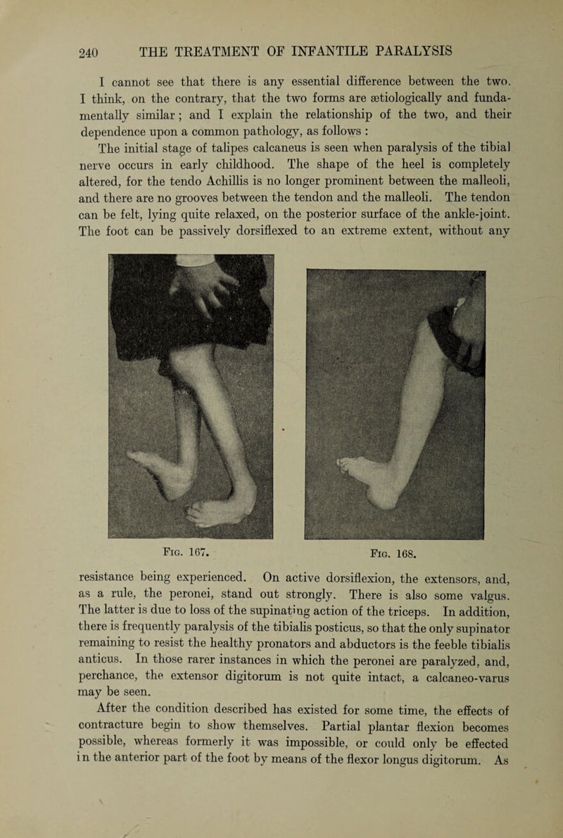 I cannot see that there is any essential difference between the two. I think, on the contrary, that the two forms are setiologically and funda¬ mentally similar ; and I explain the relationship of the two, and their dependence upon a common pathology, as follows : The initial stage of talipes calcaneus is seen when paralysis of the tibia) nerve occurs in early childhood. The shape of the heel is completely altered, for the tendo Achillis is no longer prominent between the malleoli, and there are no grooves between the tendon and the malleoli. The tendon can be felt, lying quite relaxed, on the posterior surface of the ankle-joint. The foot can be passively dorsiflexed to an extreme extent, without any Fig. 167. Fig. 168. resistance being experienced. On active dorsiflexion, the extensors, and, as a rule, the peronei, stand out strongly. There is also some valgus. The latter is due to loss of the supinatmg action of the triceps. In addition, there is frequently paralysis of the tibialis posticus, so that the only supinator remaining to resist the healthy pronators and abductors is the feeble tibialis anticus. In those rarer instances in which the peronei are paralyzed, and, perchance, the extensor digitorum is not quite intact, a calcaneo-varus may be seen. After the condition described has existed for some time, the effects of contracture begin to show themselves. Partial plantar flexion becomes possible, whereas formerly it was impossible, or could only be effected in the anterior part of the foot by means of the flexor longus digitorum. As