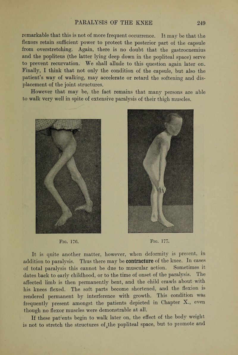 remarkable that this is not of more frequent occurrence. It may be that the flexors retain sufficient power to protect the posterior part of the capsule from overstretching. Again, there is no doubt that the gastrocnemius and the popliteus (the latter lying deep down in the popliteal space) serve to prevent recurvation. We shall allude to this question again later on. Finally, I think that not only the condition of the capsule, but also the patient’s way of walking, may accelerate or retard the softening and dis¬ placement of the joint structures. However that may be, the fact remains that many persons are able to walk very well in spite of extensive paralysis of their thigh muscles. Fig. 176. Fig. 177. It is quite another matter, however, when deformity is present, in addition to paralysis. Thus there may be contracture of the knee. In cases of total paralysis this cannot be due to muscular action. Sometimes it dates back to early childhood, or to the time of onset of the paralysis. The affected limb is then permanently bent, and the child crawls about with his knees flexed. The soft parts become shortened, and the flexion is rendered permanent by interference with growth. This condition was frequently present amongst the patients depicted in Chapter X., even though no flexor muscles were demonstrable at all. If these parents begin to walk later on, the effect of the body weight is not to stretch the structures of^the popliteal space, but to promote and