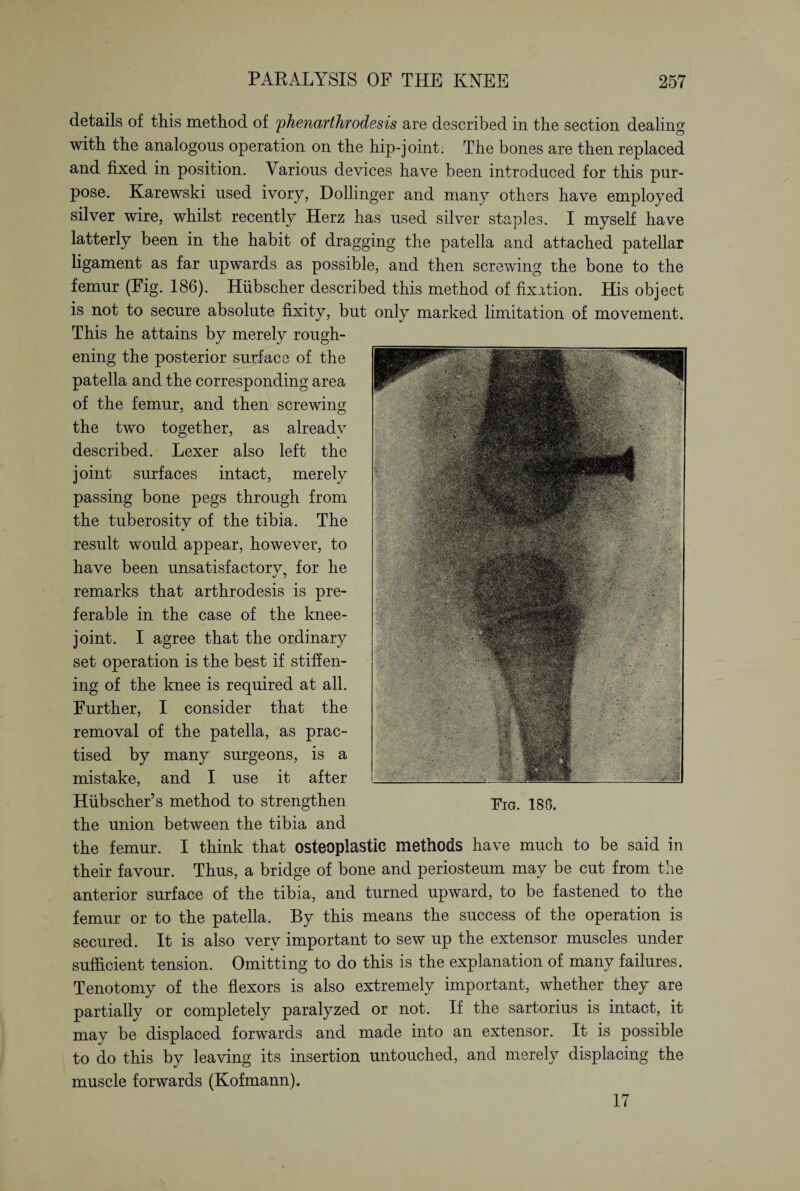details of this method of phenarthrodesis are described in the section dealing with the analogous operation on the hip-joint. The bones are then replaced and fixed in position. Various devices have been introduced for this pur¬ pose. Karewski used ivory, Dollinger and many others have employed silver wire, whilst recently Herz has used silver staples. I myself have latterly been in the habit of dragging the patella and attached patellar ligament as far upwards as possible, and then screwing the bone to the femur (Fig. 186). Hübscher described this method of fixation. His object is not to secure absolute fixity, but only marked limitation of movement. This he attains by merely rough¬ ening the posterior surface of the patella and the corresponding area of the femur, and then screwing the two together, as already described. Lexer also left the joint surfaces intact, merely passing bone pegs through from the tuberosity of the tibia. The result would appear, however, to have been unsatisfactory, for he remarks that arthrodesis is pre¬ ferable in the case of the knee- joint. I agree that the ordinary set operation is the best if stiffen¬ ing of the knee is required at all. Further, I consider that the removal of the patella, as prac¬ tised by many surgeons, is a mistake, and I use it after Hübscher’s method to strengthen the union between the tibia and the femur. I think that osteoplastic methods have much to be said in their favour. Thus, a bridge of bone and periosteum may be cut from the anterior surface of the tibia, and turned upward, to be fastened to the femur or to the patella. By this means the success of the operation is secured. It is also very important to sew up the extensor muscles under sufficient tension. Omitting to do this is the explanation of many failures. Tenotomy of the flexors is also extremely important, whether they are partially or completely paralyzed or not. If the sartorius is intact, it may be displaced forwards and made into an extensor. It is possible to do this by leaving its insertion untouched, and merely displacing the muscle forwards (Kofmann). 17