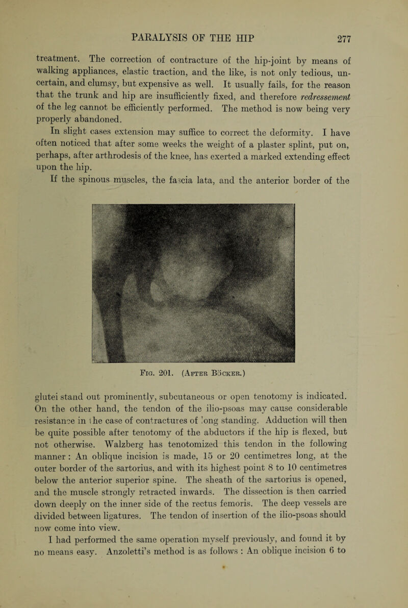 treatment. The correction of contracture of the hip-joint by means of walking appliances, elastic traction, and the like, is not only tedious, un¬ certain, and clumsy, but expensive as well. It usually fails, for the reason that the trunk and hip are insufficiently fixed, and therefore redressement of the leg cannot be efficiently performed. The method is now being very properly abandoned. In slight cases extension may suffice to correct the deformity. I have often noticed that after some weeks the weight of a plaster splint, put on, perhaps, after arthrodesis of the knee, has exerted a marked extending effect upon the hip. If the spinous muscles, the fascia lata, and the anterior border of the Fig. 201. (After Böcker.) glutei stand out prominently, subcutaneous or open tenotomy is indicated. On the other hand, the tendon of the ilio-psoas may cause considerable resistance in the case of contractures of iong standing. Adduction will then be quite possible after tenotomy of the abductors if the hip is flexed, but not otherwise. Walzberg has tenotomized this tendon in the following manner : An oblique incision is made, 15 or 20 centimetres long, at the outer border of the sartorius, and with its highest point 8 to 10 centimetres below the anterior superior spine. The sheath of the sartorius is opened, and the muscle strongly retracted inwards. The dissection is then carried down deeply on the inner side of the rectus femoris. The deep vessels are divided between ligatures. The tendon of insertion of the ilio-psoas should now come into view. I had performed the same operation myself previously, and found it by no means easy. Anzoletti’s method is as follows : An oblique incision 6 to