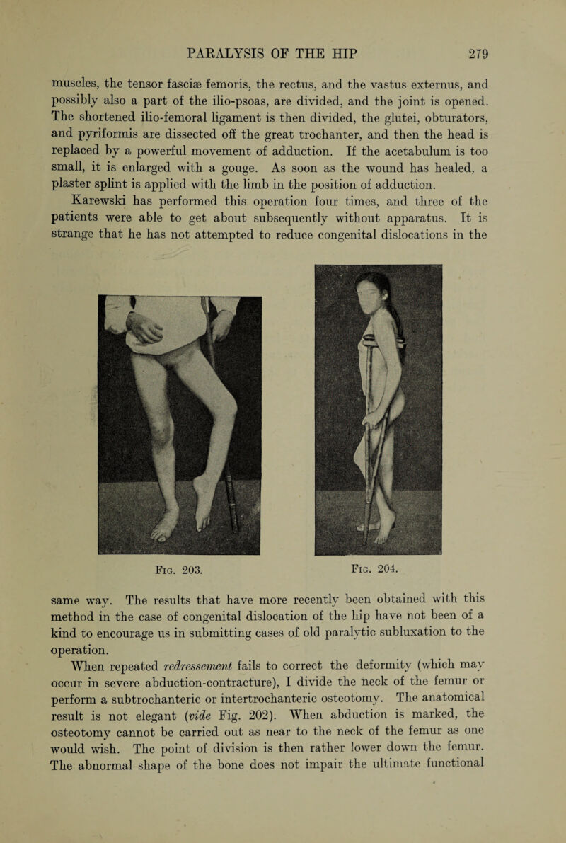 muscles, the tensor fasciae femoris, the rectus, and the vastus externus, and possibly also a part of the ilio-psoas, are divided, and the joint is opened. The shortened ilio-femoral ligament is then divided, the glutei, obturators, and pyriformis are dissected off the great trochanter, and then the head is replaced by a powerful movement of adduction. If the acetabulum is too small, it is enlarged with a gouge. As soon as the wound has healed, a plaster splint is applied with the limb in the position of adduction. Karewski has performed this operation four times, and three of the patients were able to get about subsequently without apparatus. It is strange that he has not attempted to reduce congenital dislocations in the Fig. 203. Fig. 204. same way. The results that have more recently been obtained with this method in the case of congenital dislocation of the hip have not been of a kind to encourage us in submitting cases of old paralytic subluxation to the operation. When repeated redressement fails to correct the deformity (which may occur in severe abduction-contracture), I divide the neck of the femur or perform a subtrochanteric or intertrochanteric osteotomy. The anatomical result is not elegant (vide Fig. 202). When abduction is marked, the osteotomy cannot be carried out as near to the neck of the femur as one would wish. The point of division is then rather lower down the femur. The abnormal shape of the bone does not impair the ultimate functional