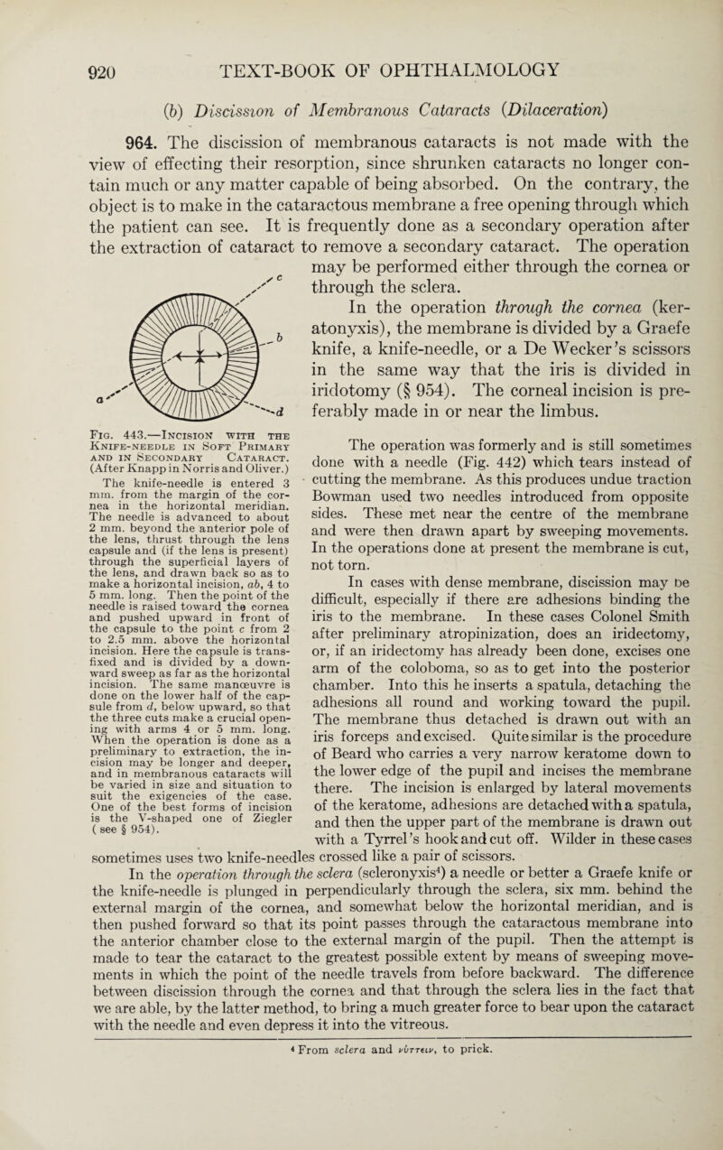 (6) Discission of Membranous Cataracts (.Dilaceration) 964. The discission of membranous cataracts is not made with the view of effecting their resorption, since shrunken cataracts no longer con¬ tain much or any matter capable of being absorbed. On the contrary, the object is to make in the cataractous membrane a free opening through which the patient can see. It is frequently done as a secondary operation after to remove a secondary cataract. The operation may be performed either through the cornea or through the sclera. In the operation through the cornea (ker- atonyxis), the membrane is divided by a Graefe knife, a knife-needle, or a De Wecker’s scissors in the same way that the iris is divided in iridotomy (§ 954). The corneal incision is pre¬ ferably made in or near the limbus. The operation was formerly and is still sometimes done with a needle (Fig. 442) which tears instead of cutting the membrane. As this produces undue traction Bowman used two needles introduced from opposite sides. These met near the centre of the membrane and were then drawn apart by sweeping movements. In the operations done at present the membrane is cut, not torn. In cases with dense membrane, discission may De difficult, especially if there are adhesions binding the iris to the membrane. In these cases Colonel Smith after preliminary atropinization, does an iridectomy, or, if an iridectomy has already been done, excises one arm of the coloboma, so as to get into the posterior chamber. Into this he inserts a spatula, detaching the adhesions all round and working toward the pupil. The membrane thus detached is drawn out with an iris forceps and excised. Quite similar is the procedure of Beard who carries a very narrow keratome down to the lower edge of the pupil and incises the membrane there. The incision is enlarged by lateral movements of the keratome, adhesions are detached with a spatula, and then the upper part of the membrane is drawn out with a Tyrrel’s hook and cut off. Wilder in these cases sometimes uses two knife-needles crossed like a pair of scissors. In the operation through the sclera (scleronyxis4) a needle or better a Graefe knife or the knife-needle is plunged in perpendicularly through the sclera, six mm. behind the external margin of the cornea, and somewhat below the horizontal meridian, and is then pushed forward so that its point passes through the cataractous membrane into the anterior chamber close to the external margin of the pupil. Then the attempt is made to tear the cataract to the greatest possible extent by means of sweeping move¬ ments in which the point of the needle travels from before backward. The difference between discission through the cornea and that through the sclera lies in the fact that we are able, by the latter method, to bring a much greater force to bear upon the cataract with the needle and even depress it into the vitreous. the extraction of cataract a Fig. 443.—Incision with the Knife-needle in Soft Primary and in Secondary Cataract. (After Knapp in Norris and Oliver.) The knife-needle is entered 3 min. from the margin of the cor¬ nea in the horizontal meridian. The needle is advanced to about 2 mm. beyond the anterior pole of the lens, thrust through the lens capsule and (if the lens is present) through the superficial layers of the lens, and drawn back so as to make a horizontal incision, ab, 4 to 5 mm. long. Then the point of the needle is raised toward the cornea and pushed upward in front of the capsule to the point c from 2 to 2.5 mm. above the horizontal incision. Here the capsule is trans¬ fixed and is divided by a down¬ ward sweep as far as the horizontal incision. The same manoeuvre is done on the lower half of the cap¬ sule from d, below upward, so that the three cuts make a crucial open¬ ing with arms 4 or 5 mm. long. When the operation is done as a preliminary to extraction, the in¬ cision may be longer and deeper, and in membranous cataracts will be varied in size and situation to suit the exigencies of the case. One of the best forms of incision is the V-shaped one of Ziegler ( see § 954). 4 From sclera and vürrtiv, to prick.