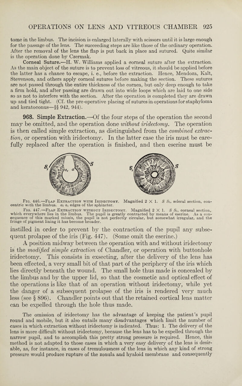 tome in the limbus. The incision is enlarged laterally with scissors until it is large enough for the passage of the lens. The succeeding steps are like those of the ordinary operation. After the removal of the lens the flap is put back in place and sutured. Quite similar is the operation done by Czermak. Corneal Suture.—H. W. Williams applied a oorneal suture after the extraction. As the main object of the suture is to prevent loss of vitreous, it should be applied before the latter has a chance to escape, i. e., before the extraction. Hence, Mendoza, Kalt, Stevenson, and others apply corneal sutures before making the section. These sutures are not passed through the entire thickness of the cornea, but only deep enough to take a firm hold, and after passing are drawn out into wide loops which are laid to one side so as not to interfere with the section. After the operation is completed they are drawn up and tied tight. (Cf. the pre-operative placing of sutures in operations for staphyloma and keratoconus—§§ 942, 944). 968. Simple Extraction.—Of the four steps of the operation the second may be omitted, and the operation done without iridectomy. The operation is then called simple extraction, as distinguished from the combined extrac¬ tion, or operation with iridectomy. In the latter case the iris must be care¬ fully replaced after the operation is finished, and then eserine must be % Fig. 446.—Flap Extraction with Iridectomy. Magnified 2X1. S Si, scleral section, con¬ centric with the limbus, ai a, edges of the sphincter. Fig. 447.—Flap Extraction without Iridectomy. Magnified 2X1. S Si, corneal section, which everywhere lies in the limbus. The pupil is greatly contracted by means of eserine. As a con¬ sequence of this marked miosis, the pupil is not perfectly circular, but somewhat irregular, and the fringe of pigment lining it has become broader. instilled in order to prevent by the contraction of the pupil any subse¬ quent prolapse of the iris (Fig. 447). (Some omit the eserine.) A position midway between the operation with and without iridectomy is the ?nodified simple extraction of Chandler, or operation with buttonhole iridectomy. This consists in exsecting, after the delivery of the lens has been effected, a very small bit of that part of the periphery of the iris which lies directly beneath the wound. The small hole thus made is concealed by the limbus and by the upper lid, so that the cosmetic and optical effect of the operations is like that of an operation without iridectomy, while yet the danger of a subsequent prolapse of the iris is rendered very much less (see § 896). Chandler points out that the retained cortical lens matter can be expelled through the hole thus made. The omission of iridectomy has the advantage of keeping the patient’s pupil round and mobile, but it also entails many disadvantages which limit the number of cases in which extraction without iridectomy is indicated. Thus: 1. The delivery of the lens is more difficult without iridectomy, because the lens has to be expelled through the narrow pupil, and to accomplish this pretty strong pressure is required. Hence, this method is not adapted to those cases in which a very easy delivery of the lens is desir¬ able, as, for instance, in cases of tremulousness of the lens in which any kind of strong pressure would produce rupture of the zonula and hyaloid membrane and consequently