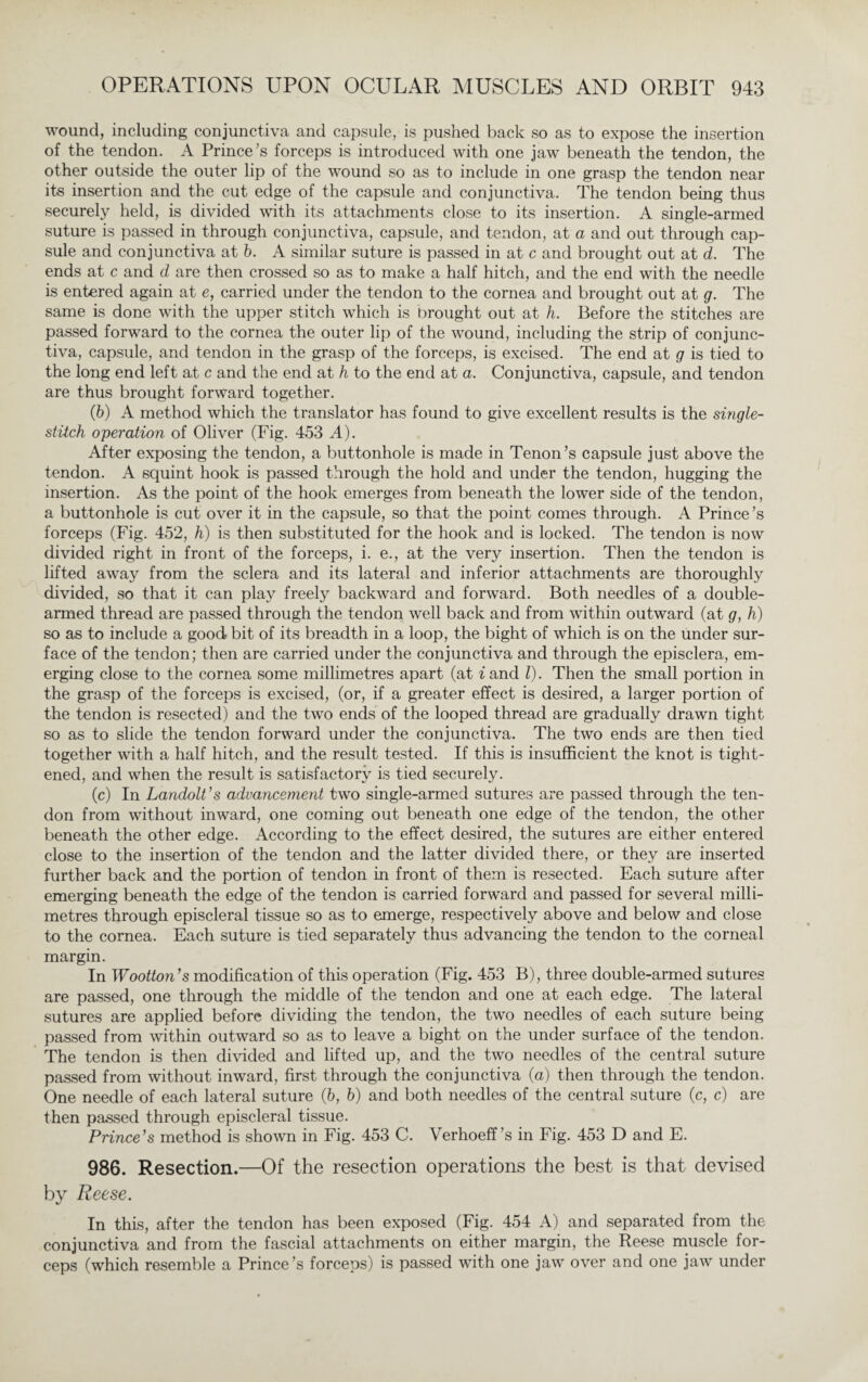wound, including conjunctiva and capsule, is pushed back so as to expose the insertion of the tendon. A Prince's forceps is introduced with one jaw beneath the tendon, the other outside the outer lip of the wound so as to include in one grasp the tendon near its insertion and the cut edge of the capsule and conjunctiva. The tendon being thus securely held, is divided with its attachments close to its insertion. A single-armed suture is passed in through conjunctiva, capsule, and tendon, at a and out through cap¬ sule and conjunctiva at b. A similar suture is passed in at c and brought out at d. The ends at c and d are then crossed so as to make a half hitch, and the end with the needle is entered again at e, carried under the tendon to the cornea and brought out at g. The same is done with the upper stitch which is brought out at h. Before the stitches are passed forward to the cornea the outer lip of the wound, including the strip of conjunc¬ tiva, capsule, and tendon in the grasp of the forceps, is excised. The end at g is tied to the long end left at c and the end at h to the end at a. Conjunctiva, capsule, and tendon are thus brought forward together. (6) A method which the translator has found to give excellent results is the single¬ stitch operation of Oliver (Fig. 453 A). After exposing the tendon, a buttonhole is made in Tenon's capsule just above the tendon. A squint hook is passed through the hold and under the tendon, hugging the insertion. As the point of the hook emerges from beneath the lower side of the tendon, a buttonhole is cut over it in the capsule, so that the point comes through. A Prince’s forceps (Fig. 452, h) is then substituted for the hook and is locked. The tendon is now divided right in front of the forceps, i. e., at the very insertion. Then the tendon is lifted away from the sclera and its lateral and inferior attachments are thoroughly divided, so that it can play freely backward and forward. Both needles of a double¬ armed thread are passed through the tendon well back and from within outward (at g, h) so as to include a good bit of its breadth in a loop, the bight of which is on the under sur¬ face of the tendon; then are carried under the conjunctiva and through the episclera, em¬ erging close to the cornea some millimetres apart (at i and l). Then the small portion in the grasp of the forceps is excised, (or, if a greater effect is desired, a larger portion of the tendon is resected) and the two ends of the looped thread are gradually drawn tight so as to slide the tendon forward under the conjunctiva. The two ends are then tied together with a half hitch, and the result tested. If this is insufficient the knot is tight¬ ened, and when the result is satisfactory is tied securely. (c) In Landolt’s advancement two single-armed sutures are passed through the ten¬ don from without inward, one coming out beneath one edge of the tendon, the other beneath the other edge. According to the effect desired, the sutures are either entered close to the insertion of the tendon and the latter divided there, or they are inserted further back and the portion of tendon in front of them is resected. Each suture after emerging beneath the edge of the tendon is carried forward and passed for several milli¬ metres through episcleral tissue so as to emerge, respectively above and below and close to the cornea. Each suture is tied separately thus advancing the tendon to the corneal margin. In Wootton’s modification of this operation (Fig. 453 B), three double-armed sutures are passed, one through the middle of the tendon and one at each edge. The lateral sutures are applied before dividing the tendon, the two needles of each suture being passed from within outward so as to leave a bight on the under surface of the tendon. The tendon is then divided and lifted up, and the two needles of the central suture passed from without inward, first through the conjunctiva (a) then through the tendon. One needle of each lateral suture (6, b) and both needles of the central suture (c, c) are then passed through episcleral tissue. Prince's method is shown in Fig. 453 C. Verhoeff's in Fig. 453 D and E. 986. Resection.—Of the resection operations the best is that devised by Reese. In this, after the tendon has been exposed (Fig. 454 A) and separated from the conjunctiva and from the fascial attachments on either margin, the Reese muscle for¬ ceps (which resemble a Prince’s forceps) is passed with one jaw over and one jaw under
