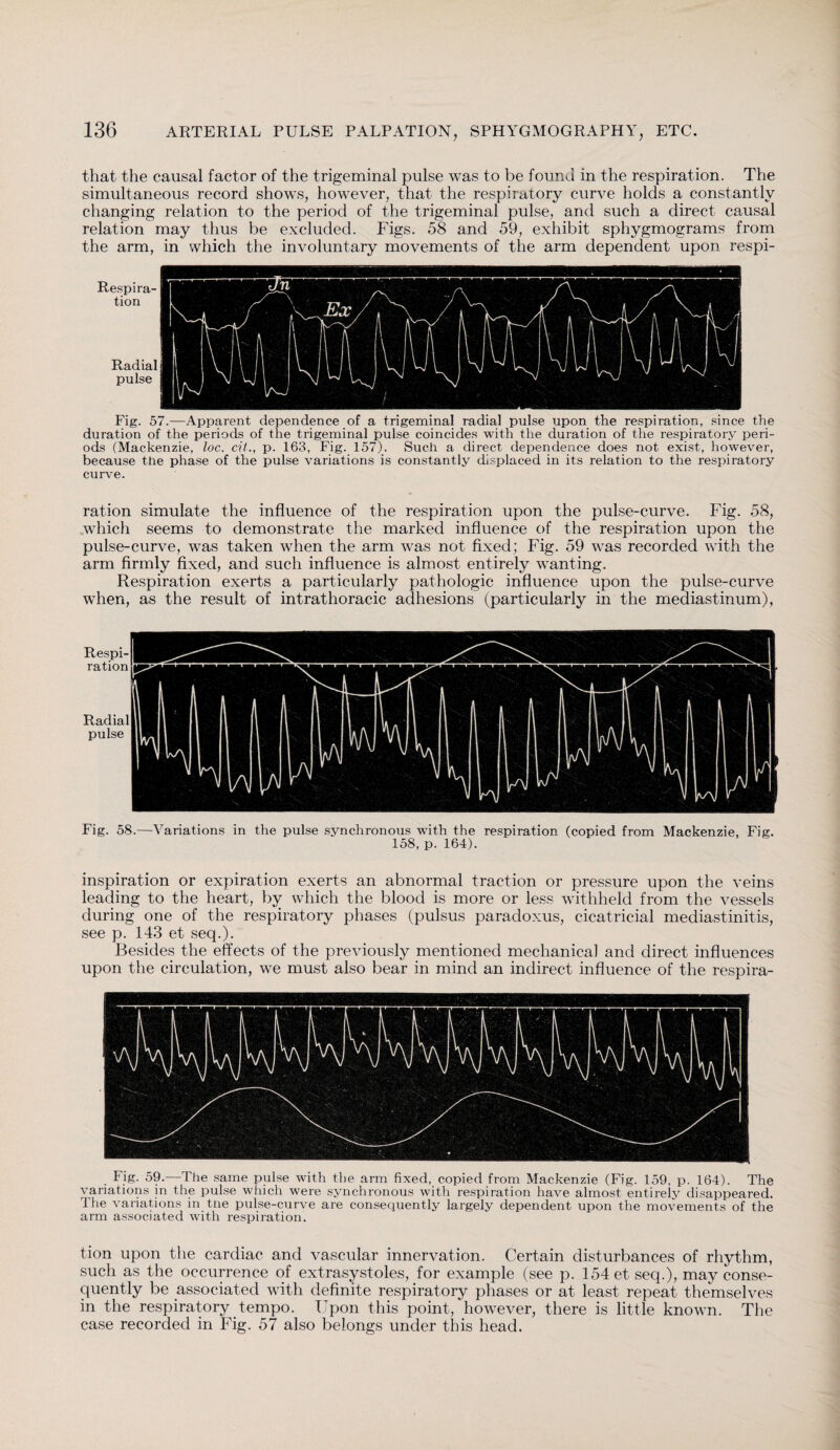 that the causal factor of the trigeminal pulse was to be found in the respiration. The simultaneous record shows, however, that the respiratory curve holds a constantly changing relation to the period of the trigeminal pulse, and such a direct causal relation may thus be excluded. Figs. 58 and 59, exhibit sphygmograms from the arm, in which the involuntary movements of the arm dependent upon respi- Re.spi ra¬ tion Radial pulse Fig. 57.—Apparent dependence of a trigeminal radial pulse upon the respiration, since the duration of the periods of the trigeminal pulse coincides with the duration of the respiratory peri¬ ods (Mackenzie, loc. cit., p. 163, Fig. 157). Sucii a direct dependence does not exist, however, because the phase of the pulse variations is constantly displaced in its relation to the respiratory curve. ration simulate the influence of the respiration upon the pulse-curve. Fig. 58, which seems to demonstrate the marked influence of the respiration upon the pulse-curve, was taken when the arm was not fixed; Fig. 59 was recorded with the arm firmly fixed, and such influence is almost entirely wanting. Respiration exerts a particularly pathologic influence upon the pulse-curve when, as the result of intrathoracic adhesions (particularly in the mediastinum), Fig. 58.—Variations in the pulse synchronous with the respiration (copied from Mackenzie, Fig. 158, p. 164). inspiration or expiration exerts an abnormal traction or pressure upon the veins leading to the heart, by which the blood is more or less withheld from the vessels during one of the respiratory phases (pulsus paradoxus, cicatricial mediastinitis, see p. 143 et seq.). Besides the effects of the previously mentioned mechanical and direct influences upon the circulation, we must also bear in mind an indirect influence of the respira- Fig. 59.—The same pulse with the arm fixed, copied from Mackenzie (Fig. 159, p. 164). The variations in the pulse which were synchronous with respiration have almost entirely disappeared. The variations in the pulse-curve are consequently largely dependent upon the movements of the arm associated with respiration. tion upon the cardiac and vascular innervation. Certain disturbances of rhythm, such as the occurrence of extrasystoles, for example (see p. 154 et seq.), may conse¬ quently be associated with definite respiratory phases or at least repeat themselves in the respiratory tempo. Upon this point, however, there is little known. The case recorded in Fig. 57 also belongs under this head.