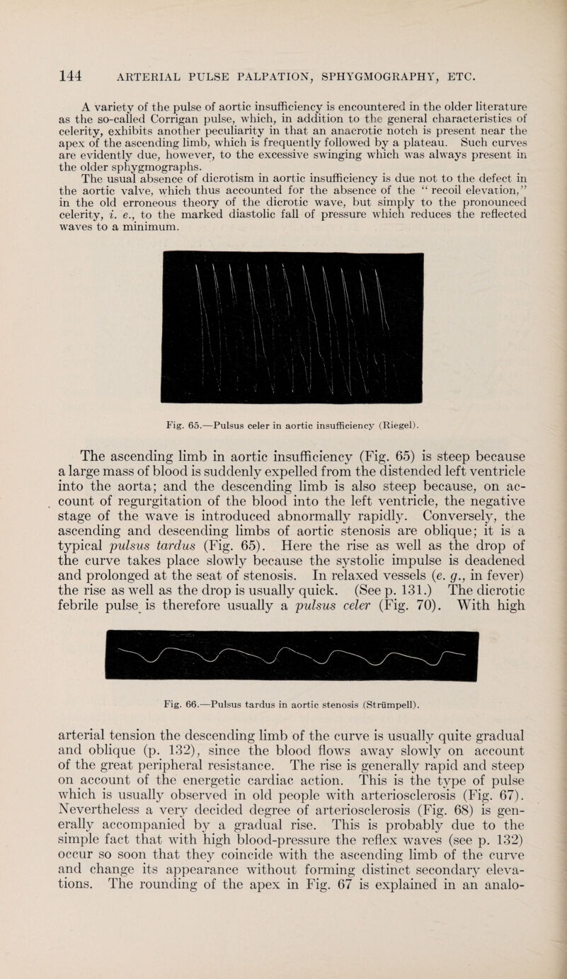 A variety of the pulse of aortic insufficiency is encountered in the older literature as the so-called Corrigan pulse, which, in addition to the general characteristics of celerity, exhibits another peculiarity in that an anacrotic notch is present near the apex of the ascending limb, which is frequently followed by a plateau. Such curves are evidently due, however, to the excessive swinging which was always present in the older sphygmographs. The usual absence of dicrotism in aortic insufficiency is due not to the defect in the aortic valve, which thus accounted for the absence of the “ recoil elevation,” in the old erroneous theory of the dicrotic wave, but simply to the pronounced celerity, i. e., to the marked diastolic fall of pressure which reduces the reflected waves to a minimum. Fig. 65.—Pulsus celer in aortic insufficiency (Riegel). The ascending limb in aortic insufficiency (Fig. 65) is steep because a large mass of blood is suddenly expelled from the distended left ventricle into the aorta; and the descending limb is also steep because, on ac¬ count of regurgitation of the blood into the left ventricle, the negative stage of the wave is introduced abnormally rapidly. Conversely, the ascending and descending limbs of aortic stenosis are oblique; it is a typical pulsus tardus (Fig. 65). Here the rise as well as the drop of the curve takes place slowly because the systolic impulse is deadened and prolonged at the seat of stenosis. In relaxed vessels (e. g., in fever) the rise as well as the drop is usually quick. (See p. 131.) The dicrotic febrile pulse is therefore usually a pulsus celer (Fig. 70). With high Fig. 66.—Pulsus tardus in aortic stenosis (Strümpell). arterial tension the descending limb of the curve is usually quite gradual and oblique (p. 132), since the blood flows away slowly on account of the great peripheral resistance. The rise is generally rapid and steep on account of the energetic cardiac action. This is the type of pulse which is usually observed in old people with arteriosclerosis (Fig. 67). Nevertheless a very decided degree of arteriosclerosis (Fig. 68) is gen¬ erally accompanied by a gradual rise. This is probably due to the simple fact that with high blood-pressure the reflex waves (see p. 132) occur so soon that they coincide with the ascending limb of the curve and change its appearance without forming distinct secondary eleva¬ tions. The rounding of the apex in Fig. 67 is explained in an analo-