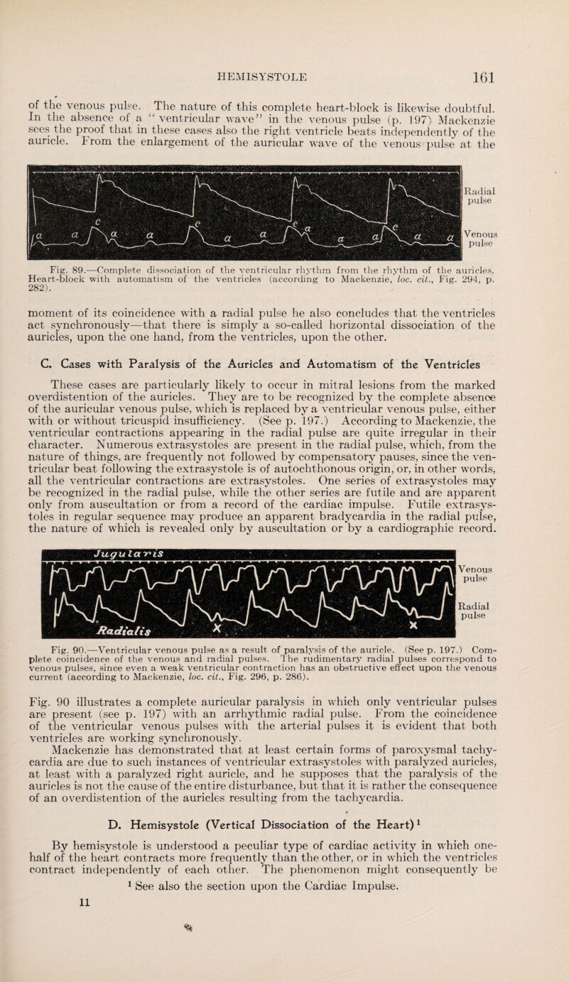 of the venous pulse. The nature of this complete heart-block is likewise doubtful. In the absence of a “ ventricular wave” in the venous pulse (p. 197) Mackenzie sees the proof that in these cases also the right ventricle beats independently of the auricle. From the enlargement of the auricular wave of the venous pulse at the Radial pulse Venous pulse Fig. 89.—Complete dissociation of the ventricular rhythm from the rhythm of the auricles. Heart-block with automatism of the ventricles (according to Mackenzie, loc. cit., Fig. 294, p. 282). moment of its coincidence with a radial pulse he also concludes that the ventricles act synchronously—that there is simply a so-called horizontal dissociation of the auricles, upon the one hand, from the ventricles, upon the other. C. Cases with Paralysis of the Auricles and Automatism of the Ventricles These cases are particularly likely to occur in mitral lesions from the marked overdistention of the auricles. They are to be recognized by the complete absence of the auricular venous pulse, which is replaced by a ventricular venous pulse, either with or without tricuspid insufficiency. (See p. 197.) According to Mackenzie, the ventricular contractions appearing in the radial pulse are quite irregular in their character. Numerous extrasystoles are present in the radial pulse, which, from the nature of things, are frequently not followed by compensatory pauses, since the ven¬ tricular beat following the extrasystole is of autochthonous origin, or, in other words, all the ventricular contractions are extrasystoles. One series of extrasystoles may be recognized in the radial pulse, while the other series are futile and are apparent only from auscultation or from a record of the cardiac impulse. Futile extrasys¬ toles in regular sequence may produce an apparent bradycardia in the radial pulse, the nature of which is revealed only by auscultation or by a cardiographic record. Venous pulse Radial pulse Fig. 90.—Ventricular venous pulse as a result of paralysis of the auricle. (See p. 197.) Com¬ plete coincidence of the venous and radial pulses. The rudimentary radial pulses correspond to venous pulses, since even a weak ventricular contraction has an obstructive effect upon the venous current (according to Mackenzie, loc. cit., Fig. 296, p. 286). Fig. 90 illustrates a complete auricular paralysis in which only ventricular pulses are present (see p. 197) with an arrhythmic radial pulse. From the coincidence of the ventricular venous pulses with the arterial pulses it is evident that both ventricles are working synchronously. Mackenzie has demonstrated that at least certain forms of paroxysmal tachy¬ cardia are due to such instances of ventricular extrasystoles with paralyzed auricles, at least with a paralyzed right auricle, and he supposes that the paralysis of the auricles is not the cause of the entire disturbance, but that it is rather the consequence of an overdistention of the auricles resulting from the tachycardia. rf D. Hemisystole (Vertical Dissociation of the Heart)1 By hemisystole is understood a peculiar type of cardiac activity in which one- half of the heart contracts more frequently than the other, or in which the ventricles contract independently of each other. The phenomenon might consequently be 1 See also the section upon the Cardiac Impulse. II