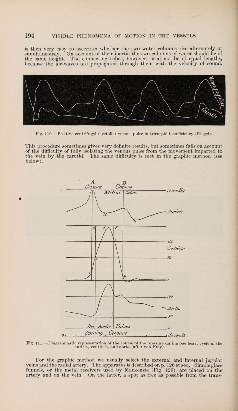 is then very easy to ascertain whether the two water columns rise alternately or simultaneously. On account of their inertia the two columns of water should be of the same height. The connecting tubes, however, need not be of equal lengths, because the air-waves are propagated through them with the velocity of sound. Fig. 110.—Positive centrifugal (systolic) venous pulse in tricuspid insufficiency (Kiegel). This procedure sometimes gives very definite results, but sometimes fails on account of the difficulty of fully isolating the venous pulse from the movement imparted to the vein by the carotid. The same difficulty is met in the graphic method (see below). Fig. 111.—Diagrammatic representation of the course of the pressure during one heart cycle in the auricle, ventricle, and aorta (after von Frey). For the graphic method we usually select the external and internal jugular veins and the radial artery. The apparatus is described on p. 126 et seq. Simple glass funnels, or the metal receivers used by Mackenzie (Fig. 129), are placed on the artery and on the vein. On the latter, a spot as free as possible from the trans-