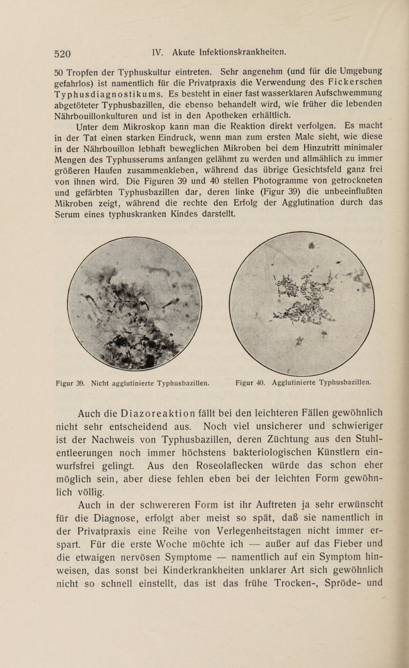 50 Tropfen der Typhuskultur eintreten. Sehr angenehm (und für die Umgebung gefahrlos) ist namentlich für die Privatpraxis die Verwendung des Fick ersehen Typhusdiagnostikums. Es besteht in einer fast wasserklaren Aufschwemmung abgetöteter Typhusbazillen, die ebenso behandelt wird, wie früher die lebenden Nährbouillonkulturen und ist in den Apotheken erhältlich. Unter dem Mikroskop kann man die Reaktion direkt verfolgen. Es macht in der Tat einen starken Eindruck, wenn man zum ersten Male sieht, wie diese in der Nährbouillon lebhaft beweglichen Mikroben bei dem Hinzutritt minimaler Mengen des Typhusserums anfangen gelähmt zu werden und allmählich zu immer größeren Haufen zusammenkleben, während das übrige Gesichtsfeld ganz frei von ihnen wird. Die Figuren 39 und 40 stellen Photogramme von getrockneten und gefärbten Typhusbazillen dar, deren linke (Figur 39) die unbeeinflußten Mikroben zeigt, während die rechte den Erfolg der Agglutination durch das Serum eines typhuskranken Kindes darstellt. Figur 39. Nicht agglutinierte Typhusbazillen. Figur 40. Agglutinierte Typhusbazillen. Auch die Diazoreaktion fällt bei den leichteren Fällen gewöhnlich nicht sehr entscheidend aus. Noch viel unsicherer und schwieriger ist der Nachweis von Typhusbazillen, deren Züchtung aus den Stuhl¬ entleerungen noch immer höchstens bakteriologischen Künstlern ein¬ wurfsfrei gelingt. Aus den Roseolaflecken würde das schon eher möglich sein, aber diese fehlen eben bei der leichten Form gewöhn¬ lich völlig. Auch in der schwereren Form ist ihr Auftreten ja sehr erwünscht für die Diagnose, erfolgt aber meist so spät, daß sie namentlich in der Privatpraxis eine Reihe von Verlegenheitstagen nicht immer er¬ spart. Für die erste Woche möchte ich — außer auf das Fieber und die etwaigen nervösen Symptome — namentlich auf ein Symptom hin- weisen, das sonst bei Kinderkrankheiten unklarer Art sich gewöhnlich nicht so schnell einstellt, das ist das frühe Trocken-, Spröde- und
