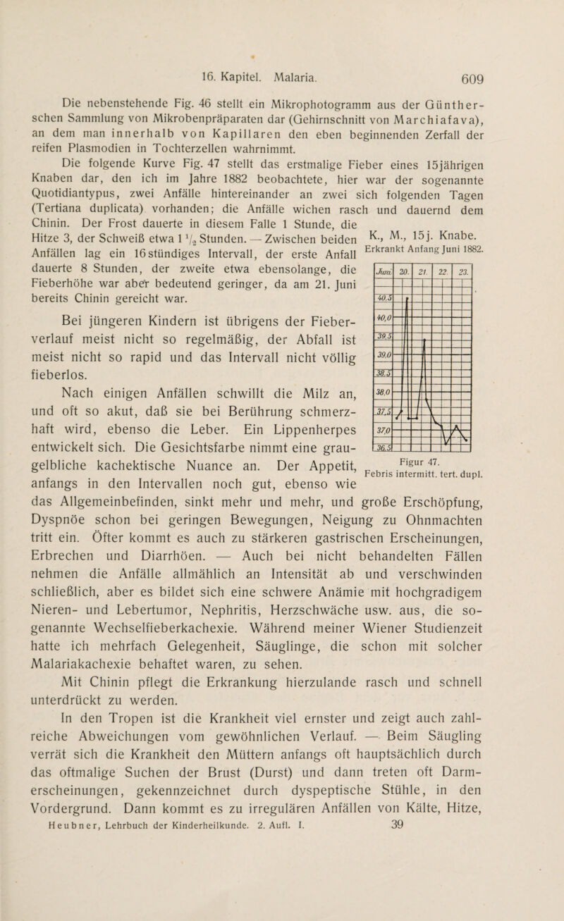 Die nebenstehende Fig. 46 stellt ein Mikrophotogramm aus der Günther- schen Sammlung von Mikrobenpräparaten dar (Gehirnschnitt von Marchiafava), an dem man innerhalb von Kapillaren den eben beginnenden Zerfall der reifen Plasmodien in Tochterzellen wahrnimmt. Die folgende Kurve Fig. 47 stellt das erstmalige Fieber eines 15jährigen Knaben dar, den ich im Jahre 1882 beobachtete, hier war der sogenannte Quotidiantypus, zwei Anfälle hintereinander an zwei sich folgenden Tagen (Tertiana duplicata) vorhanden; die Anfälle wichen rasch und dauernd dem Chinin. Der Frost dauerte in diesem Falle 1 Stunde, die Hitze 3, der Schweiß etwa 1 */2 Stunden. — Zwischen beiden ^1* Knabe. Anfällen lag ein 16stündiges Intervall, der erste Anfall Erkrankt Anfans Juni 1882- dauerte 8 Stunden, der zweite etwa ebensolange, die Fieberhöhe war aber bedeutend geringer, da am 21. Juni bereits Chinin gereicht war. Bei jüngeren Kindern ist übrigens der Fieber¬ verlauf meist nicht so regelmäßig, der Abfall ist meist nicht so rapid und das Intervall nicht völlig fieberlos. Nach einigen Anfällen schwillt die Milz an, und oft so akut, daß sie bei Berührung schmerz¬ haft wird, ebenso die Leber. Ein Lippenherpes entwickelt sich. Die Gesichtsfarbe nimmt eine grau¬ gelbliche kachektische Nuance an. Der Appetit, ö ’ Febnsmtermitt.tert.dupl. anfangs in den Intervallen noch gut, ebenso wie das Allgemeinbefinden, sinkt mehr und mehr, und große Erschöpfung, Dyspnoe schon bei geringen Bewegungen, Neigung zu Ohnmächten tritt ein. Öfter kommt es auch zu stärkeren gastrischen Erscheinungen, Erbrechen und Diarrhöen. — Auch bei nicht behandelten Fällen nehmen die Anfälle allmählich an Intensität ab und verschwinden schließlich, aber es bildet sich eine schwere Anämie mit hochgradigem Nieren- und Lebertumor, Nephritis, Herzschwäche usw. aus, die so¬ genannte Wechselfieberkachexie. Während meiner Wiener Studienzeit hatte ich mehrfach Gelegenheit, Säuglinge, die schon mit solcher Malariakachexie behaftet waren, zu sehen. Mit Chinin pflegt die Erkrankung hierzulande rasch und schnell unterdrückt zu werden. In den Tropen ist die Krankheit viel ernster und zeigt auch zahl¬ reiche Abweichungen vom gewöhnlichen Verlauf. — Beim Säugling verrät sich die Krankheit den Müttern anfangs oft hauptsächlich durch das oftmalige Suchen der Brust (Durst) und dann treten oft Darm¬ erscheinungen, gekennzeichnet durch dyspeptische Stühle, in den Vordergrund. Dann kommt es zu irregulären Anfällen von Kälte, Hitze, Heubner, Lehrbuch der Kinderheilkunde. 2. Aufl. I. 39