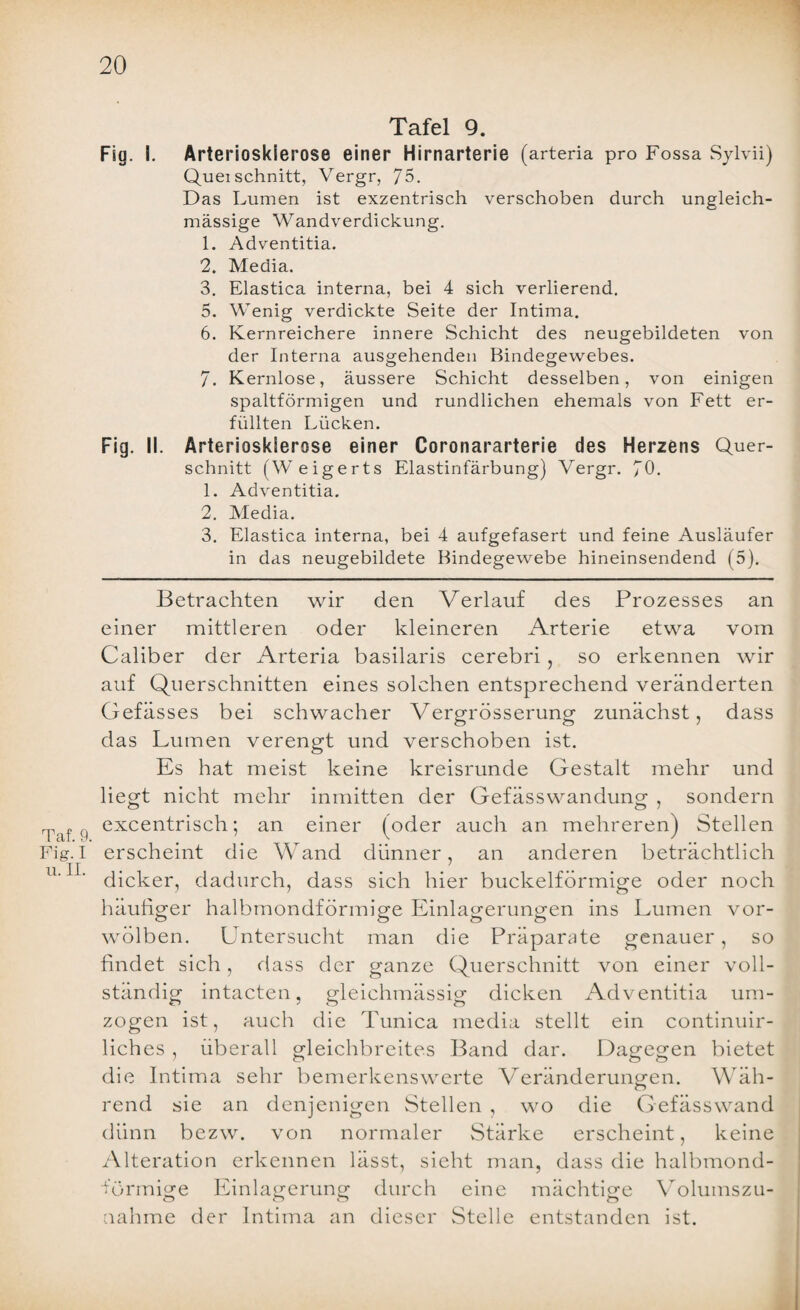 Tafel 9. Fig. I. Arteriosklerose einer Hirnarterie (arteria pro Fossa Sylvii) Queischnitt, Vergr, 75. Das Lumen ist exzentrisch verschoben durch ungleich- massige Wandverdickung. 1. Adventitia. 2. Media. 3. Elastica interna, bei 4 sich verlierend. 5. Wenig verdickte Seite der Intima. 6. Kernreichere innere Schicht des neugebildeten von der Interna ausgehenden Bindegewebes. 7. Kernlose, äussere Schicht desselben, von einigen spaltförmigen und rundlichen ehemals von Fett er¬ füllten Lücken. Fig. II. Arteriosklerose einer Coronararterie des Herzens Quer¬ schnitt (Weigerts Elastinfärbung) Vergr. 70- 1. Adventitia. 2. Media. 3. Elastica interna, bei 4 aufgefasert und feine Ausläufer in das neugebildete Bindegewebe hineinsendend (5). Taf. 9. Fig. I u. II. Betrachten wir den Verlauf des Prozesses an einer mittleren oder kleineren Arterie etwa vom Caliber der Arteria basilaris cerebri, so erkennen wir auf Querschnitten eines solchen entsprechend veränderten Gefässes bei schwacher Vergrösserung zunächst, dass das Lumen verengt und verschoben ist. Es hat meist keine kreisrunde Gestalt mehr und liegt nicht mehr inmitten der Gefässwandung , sondern excentrisch; an einer (oder auch an mehreren) Stellen erscheint die Wand dünner, an anderen beträchtlich dicker, dadurch, dass sich hier buckelförmige oder noch häufiger halbmondförmige Einlagerungen ins Lumen vor¬ wölben. Untersucht man die Präparate genauer, so findet sich, dass der ganze Querschnitt von einer voll¬ ständig intacten, gleichmässig dicken Adventitia um¬ zogen ist, auch die Tunica media stellt ein continuir- liches , überall gleichbreites Band dar. Dagegen bietet die Intima sehr bemerkenswerte Veränderungen. Wäh¬ rend sie an denjenigen Stellen , wo die Gefässwand dünn bezw. von normaler Stärke erscheint, keine Alteration erkennen lässt, sieht man, dass die halbmond¬ förmige Einlagerung durch eine mächtige Volumszu¬ nahme der Intima an dieser Stelle entstanden ist.