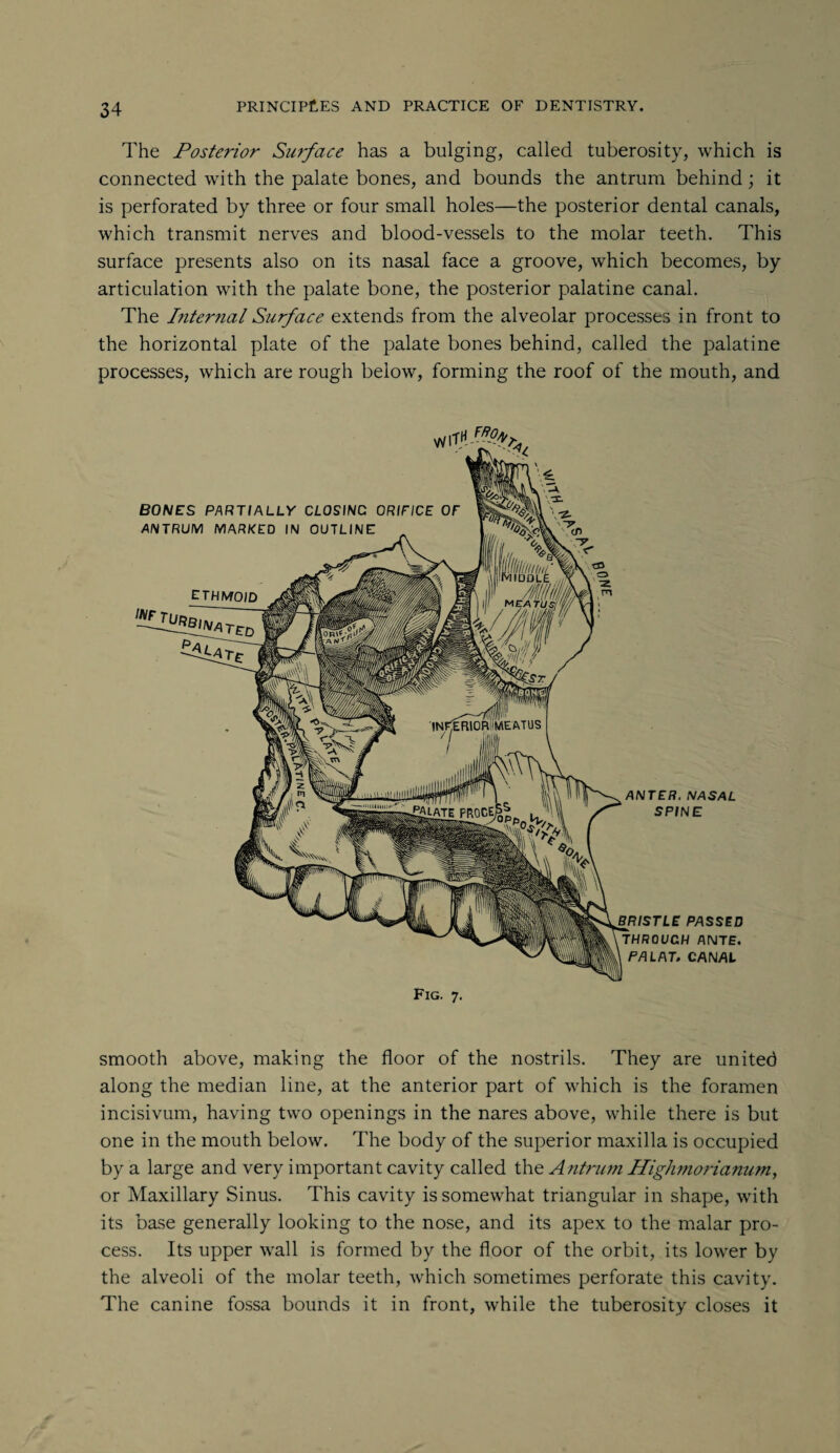 The Posterior Surface has a bulging, called tuberosity, which is connected with the palate bones, and bounds the antrum behind; it is perforated by three or four small holes—the posterior dental canals, which transmit nerves and blood-vessels to the molar teeth. This surface presents also on its nasal face a groove, which becomes, by articulation with the palate bone, the posterior palatine canal. The Internal Surface extends from the alveolar processes in front to the horizontal plate of the palate bones behind, called the palatine processes, which are rough below, forming the roof of the mouth, and smooth above, making the floor of the nostrils. They are united along the median line, at the anterior part of which is the foramen incisivum, having two openings in the nares above, while there is but one in the mouth below. The body of the superior maxilla is occupied by a large and very important cavity called the Antrum Highmorianum, or Maxillary Sinus. This cavity is somewhat triangular in shape, with its base generally looking to the nose, and its apex to the malar pro¬ cess. Its upper wall is formed by the floor of the orbit, its lower by the alveoli of the molar teeth, which sometimes perforate this cavity. The canine fossa bounds it in front, while the tuberosity closes it