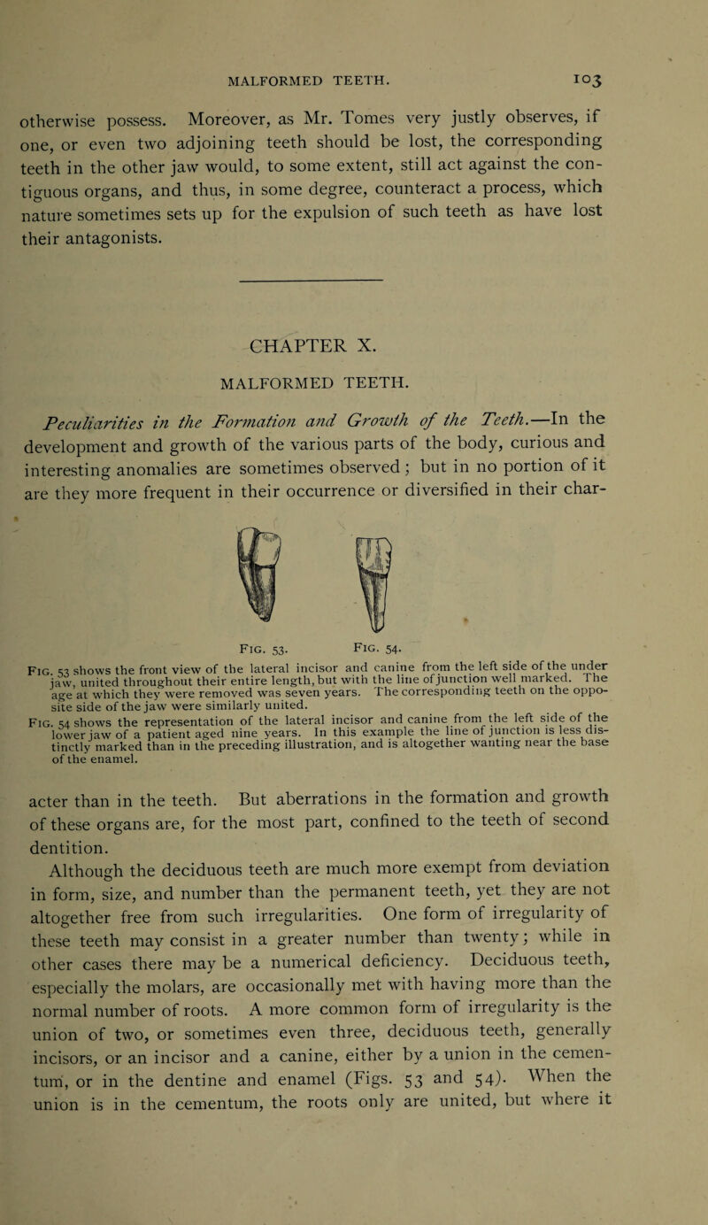 otherwise possess. Moreover, as Mr. Tomes very justly observes, if one, or even two adjoining teeth should be lost, the corresponding teeth in the other jaw would, to some extent, still act against the con¬ tiguous organs, and thus, in some degree, counteract a process, which nature sometimes sets up for the expulsion of such teeth as have lost their antagonists. CHAPTER X. MALFORMED TEETH. Peculiarities in the Formation and Growth of the Teeth.—In the development and growth of the various parts of the body, curious and interesting anomalies are sometimes observed; but in no portion of it are they more frequent in their occurrence or diversified in their char- Fig. 53. Fig. 54. Fig. S3 shows tbc front view of the lnteral incisor mid cunitie from the left side of the under jaw, united throughout their entire length, but with the line of junction well marked. The age at which they were removed was seven years. The corresponding teeth on the oppo¬ site side of the jaw were similarly united. Fig. S4 shows the representation of the lateral incisor and canine from the left side of the lower jaw of a patient aged nine years. In this example the line of junction is less dis¬ tinctly marked than in the preceding illustration, and is altogether wanting neai the base of the enamel. acter than in the teeth. But aberrations in the formation and growth of these organs are, for the most part, confined to the teeth of second dentition. Although the deciduous teeth are much more exempt from deviation in form, size, and number than the permanent teeth, yet they aie not altogether free from such irregularities. One form of irregularity of these teeth may consist in a greater number than twenty; while in other cases there may be a numerical deficiency. Deciduous teeth, especially the molars, are occasionally met with having more than the normal number of roots. A more common form of irregularity is the union of two, or sometimes even three, deciduous teeth, generally incisors, or an incisor and a canine, either by a union in the cemen- tum, or in the dentine and enamel (Figs. 53 and 54)- When the union is in the cementum, the roots only are united, but wheie it