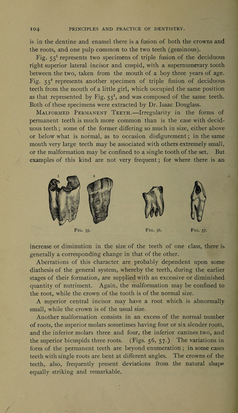 is in the dentine and enamel there is a fusion of both the crowns and the roots, and one pulp common to the two teeth (geminous). Fig. 551 represents two specimens of triple fusion of the deciduous right superior lateral incisor and cuspid, with a supernumerary tooth between the two, taken from the mouth of a boy three years of age. Fig. 552 represents another specimen of triple fusion of deciduous teeth from the mouth of a little girl, which occupied the same position as that represented by Fig. 551, and was composed of the same teeth. Both of these specimens were extracted by Dr. Isaac Douglass. Malformed Permanent Teeth.—Irregularity in the forms of permanent teeth is much more common than is the case with decid¬ uous teeth; some of the former differing so much in size, either above or below what is normal, as to occasion disfigurement; in the same mouth very large teeth may be associated with others extremely small, or the malformation may be confined to a single tooth of the set. But examples of this kind are not very frequent; for where there is an Fig. 55. Fig. 56. Fig. 57. increase or diminution in the size of the teeth of one class, there is generally a corresponding change in that of the other. Aberrations of this character, are probably dependent upon some diathesis of the general system, whereby the teeth, during the earlier stages of their formation, are supplied with an excessive or diminished quantity of nutriment. Again, the malformation may be confined to the root, while the crown of the tooth is of the normal size. A superior central incisor may have a root which is abnormally small, while the crown is of the usual size. Another malformation consists in an excess of the normal number of roots, the superior molars sometimes having four or six slender roots, and the inferior molars three and four, the inferior canines two, and the superior bicuspids three roots. (Figs. 56, 57.) The variations in form of the permanent teeth are beyond enumeration; in some cases teeth with single roots are bent at different angles. The crowns of the teeth, also, frequently present deviations from the natural shape equally striking and remarkable.