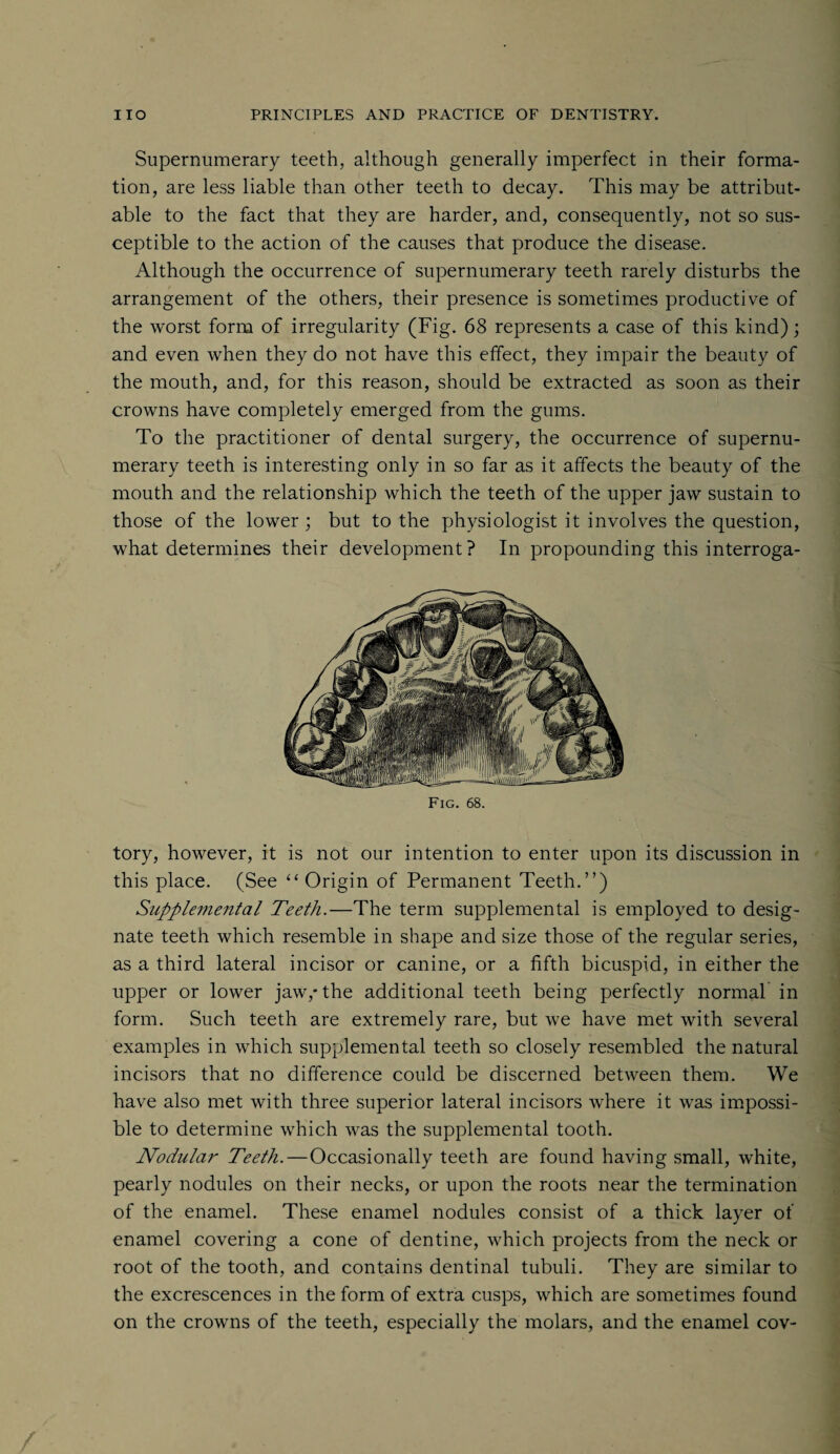 Supernumerary teeth, although generally imperfect in their forma¬ tion, are less liable than other teeth to decay. This may be attribut¬ able to the fact that they are harder, and, consequently, not so sus¬ ceptible to the action of the causes that produce the disease. Although the occurrence of supernumerary teeth rarely disturbs the arrangement of the others, their presence is sometimes productive of the worst form of irregularity (Fig. 68 represents a case of this kind); and even when they do not have this effect, they impair the beauty of the mouth, and, for this reason, should be extracted as soon as their crowns have completely emerged from the gums. To the practitioner of dental surgery, the occurrence of supernu¬ merary teeth is interesting only in so far as it affects the beauty of the mouth and the relationship which the teeth of the upper jaw sustain to those of the lower; but to the physiologist it involves the question, what determines their development? In propounding this interroga- Fig. 68. tory, however, it is not our intention to enter upon its discussion in this place. (See “ Origin of Permanent Teeth.”) Supplemental Teeth.—The term supplemental is employed to desig¬ nate teeth which resemble in shape and size those of the regular series, as a third lateral incisor or canine, or a fifth bicuspid, in either the upper or lower jaw,* the additional teeth being perfectly normal in form. Such teeth are extremely rare, but we have met with several examples in which supplemental teeth so closely resembled the natural incisors that no difference could be discerned between them. We have also met with three superior lateral incisors where it was impossi¬ ble to determine which was the supplemental tooth. Nodular Teeth. — Occasionally teeth are found having small, white, pearly nodules on their necks, or upon the roots near the termination of the enamel. These enamel nodules consist of a thick layer of enamel covering a cone of dentine, which projects from the neck or root of the tooth, and contains dentinal tubuli. They are similar to the excrescences in the form of extra cusps, which are sometimes found on the crowns of the teeth, especially the molars, and the enamel cov-