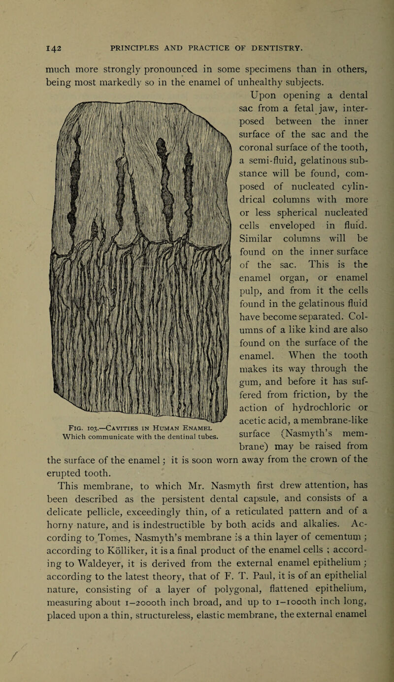 much more strongly pronounced in some specimens than in others, being most markedly so in the enamel of unhealthy subjects. Upon opening a dental sac from a fetal jaw, inter¬ posed between the inner surface of the sac and the coronal surface of the tooth, a semi-fluid, gelatinous sub¬ stance will be found, com¬ posed of nucleated cylin¬ drical columns with more or less spherical nucleated cells enveloped in fluid. Similar columns will be found on the inner surface of the sac. This is the enamel organ, or enamel pulp, and from it the cells found in the gelatinous fluid have become separated. Col¬ umns of a like kind are also found on the surface of the enamel. When the tooth makes its way through the gum, and before it has suf¬ fered from friction, by the action of hydrochloric or acetic acid, a membrane-like surface (Nasmyth’s mem¬ brane) may be raised from the surface of the enamel; it is soon worn away from the crown of the erupted tooth. This membrane, to which Mr. Nasmyth first drew attention, has been described as the persistent dental capsule, and consists of a delicate pellicle, exceedingly thin, of a reticulated pattern and of a horny nature, and is indestructible by both acids and alkalies. Ac¬ cording to Tomes, Nasmyth’s membrane is a thin layer of cementum ; according to Kolliker, it is a final product of the enamel cells ; accord¬ ing to Waldeyer, it is derived from the external enamel epithelium ; according to the latest theory, that of F. T. Paul, it is of an epithelial nature, consisting of a layer of polygonal, flattened epithelium, measuring about i-2oooth inch broad, and up to i-ioooth inch long, placed upon a thin, structureless, elastic membrane, the external enamel Fig. 103.—Cavities in Human Enamel Which communicate with the dentinal tubes.