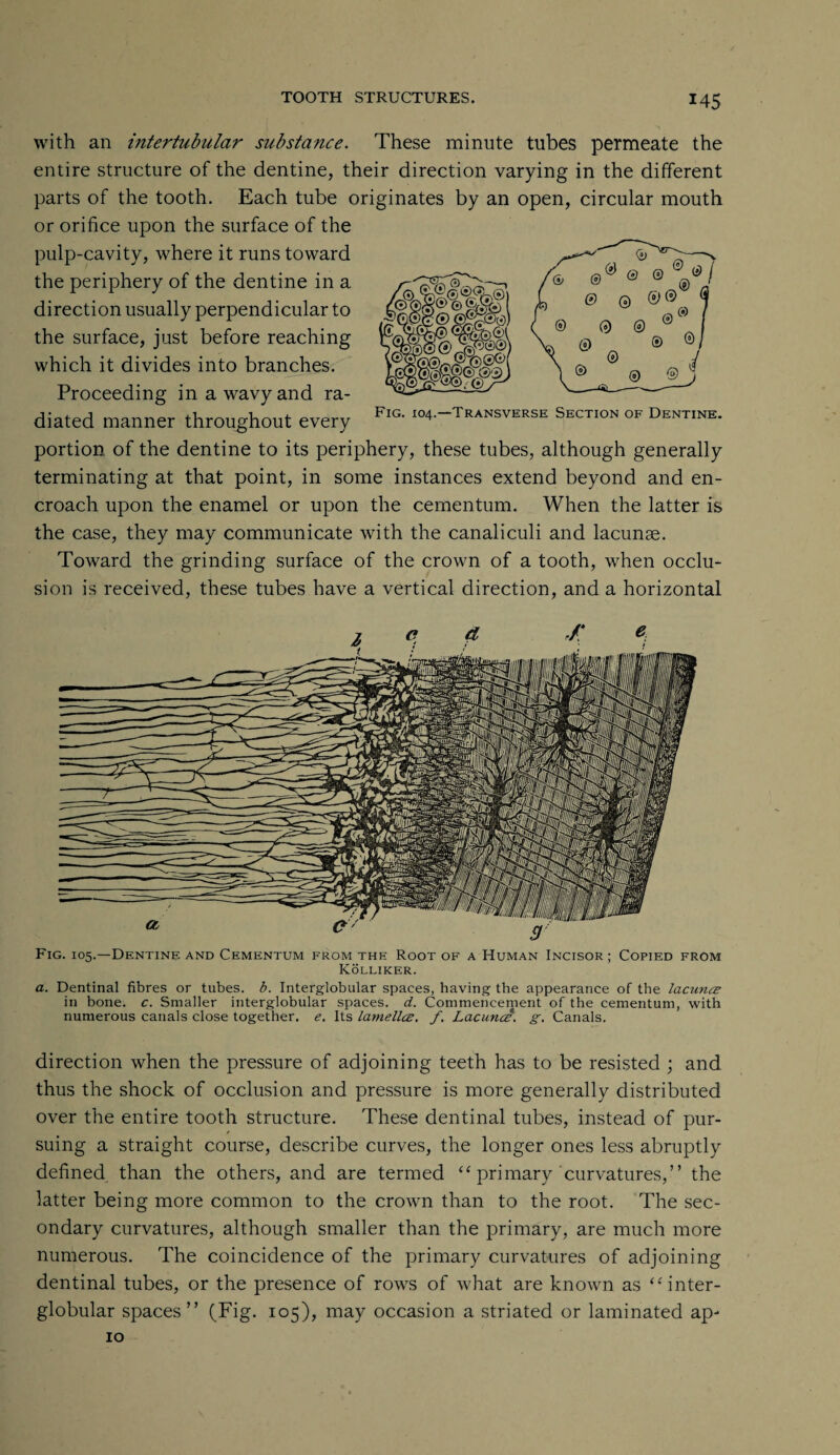 U5 with an intertubular substance. These minute tubes permeate the entire structure of the dentine, their direction varying in the different parts of the tooth. Each tube originates by an open, circular mouth or orifice upon the surface of the pulp-cavity, where it runs toward the periphery of the dentine in a direction usually perpendicular to the surface, just before reaching which it divides into branches. Proceeding in a wavy and ra¬ diated manner throughout every portion of the dentine to its periphery, these tubes, although generally terminating at that point, in some instances extend beyond and en¬ croach upon the enamel or upon the cementum. When the latter is the case, they may communicate with the canaliculi and lacunae. Toward the grinding surface of the crown of a tooth, when occlu¬ sion is received, these tubes have a vertical direction, and a horizontal Fig. 104.—Transverse Section of Dentine. Fig. 105.—Dentine and Cementum from the Root of a Human Incisor; Copied from Kolliker. a. Dentinal fibres or tubes, b. Interglobular spaces, having the appearance of the lacuncz in bone. c. Smaller interglobular spaces, d. Commencement of the cementum, with numerous canals close together, e. Its lamellcz. f. Lacunce. g. Canals. direction when the pressure of adjoining teeth has to be resisted ; and thus the shock of occlusion and pressure is more generally distributed over the entire tooth structure. These dentinal tubes, instead of pur¬ suing a straight course, describe curves, the longer ones less abruptly defined than the others, and are termed “ primary curvatures,” the latter being more common to the crown than to the root. The sec¬ ondary curvatures, although smaller than the primary, are much more numerous. The coincidence of the primary curvatures of adjoining dentinal tubes, or the presence of rows of what are known as “ inter¬ globular spaces” (Fig. 105), may occasion a striated or laminated ap- 10