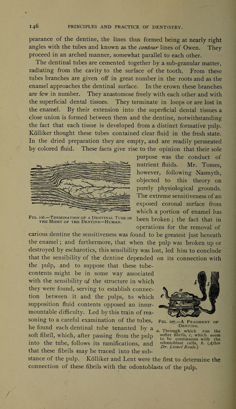 pearance of the dentine, the lines thus formed being at nearly right angles with the tubes and known as the contour lines of Owen. They proceed in an arched manner, somewhat parallel to each other. The dentinal tubes are cemented together by a sub-granular matter, radiating from the cavity to the surface of the tooth. From these tubes branches are given off in great number in the roots and as the enamel approaches the dentinal surface. In the crown these branches are few in number. They anastomose freely with each other and with the superficial dental tissues. They terminate in loops or are lost in the enamel. By their extension into the superficial dental tissues a close union is formed between them and the dentine, notwithstanding the fact that each tissue is developed from a distinct formative pulp. Kolliker thought these tubes contained clear fluid in the fresh state. In the dried preparation they are empty, and are readily permeated by colored fluid. These facts give rise to the opinion that their sole purpose was the conduct of nutrient fluids. Mr. Tomes, however, following Nasmyth, objected to this theory on purely physiological grounds. The extreme sensitiveness of an exposed coronal surface from which a portion of enamel lias Fig. 106.—Termination of a Dentinal Tube in been broken • tbe fart that in the Midst of the Dentine—Human. ueeu uroKen , me iact mat in operations for the removal of carious dentine the sensitiveness was found to be greatest just beneath the enamel; and furthermore, that when the pulp was broken up or destroyed by escharotics, this sensibility was lost, led him to conclude that the sensibility of the dentine depended on its connection with the pulp, and to suppose that these tube- contents might be in some way associated with the sensibility of the structure in which they were found, serving to establish connec¬ tion between it and the pulps, to which supposition fluid contents opposed an insur¬ mountable difficulty. Led by this train of rea¬ soning to a careful examination of the tubes, fig. 107.—a fragment of he found each dentinal tube tenanted by a dentine. j a. Through which run the soft fibril, which, after passing from the pulp softfr fibrib> o which seem . . 0 . 11 to be continuous with the into the tube, follows its ramifications, and odontoblast ceils, b. (After Dr. Lionel Beale.) that these fibrils may be traced into the sub¬ stance of the pulp. Kolliker and Lent were the first to determine the connection of these fibrils with the odontoblasts of the pulp.