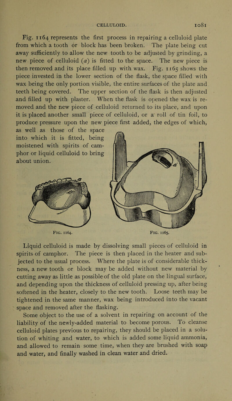 Fig. 1164 represents the first process in repairing a celluloid plate from which a tooth or block has been broken. The plate being cut away sufficiently to allow the new tooth to be adjusted by grinding, a new piece of celluloid (0) is fitted to the space. The new piece is then removed and its place filled up with wax. Fig. 1165 shows the piece invested in the lower section of the flask, the space filled with wax being the only portion visible, the entire surfaces of the plate and teeth being covered. The upper section of the flask is then adjusted and filled up with plaster. When the flask is opened the wax is re¬ moved and the new piece of celluloid returned to its place, and upon it is placed another small piece of celluloid, or a roll of tin foil, to produce pressure upon the new piece first added, the edges of which, as well as those of the space into which it is fitted, being moistened with spirits of cam¬ phor or liquid celluloid to bring about union. Fig. 1164. Fig. 1165. Liquid celluloid is made by dissolving small pieces of celluloid in spirits of camphor. The piece is then placed in the heater and sub¬ jected to the usual process. Where the plate is of considerable thick¬ ness, a new tooth or block may be added without new material by cutting away as little as possible of the old plate on the lingual surface, and depending upon the thickness of celluloid pressing up, after being softened in the heater, closely to the new tooth. Loose teeth may be tightened in the same manner, wax being introduced into the vacant space and removed after the flasking. Some object to the use of a solvent in repairing on account of the liability of the newly-added material to become porous. To cleanse celluloid plates previous to repairing, they should be placed in a solu¬ tion of whiting and water, to which is added some liquid ammonia, and allowed to remain some time, when they are brushed with soap and water, and finally washed in clean water and dried.