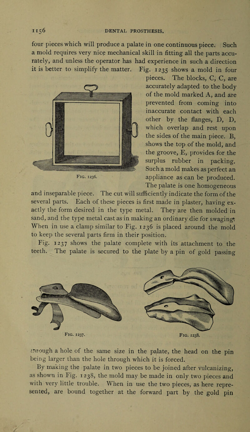 four pieces which will produce a palate in one continuous piece. Such a mold requires very nice mechanical skill in fitting all the parts accu¬ rately, and unless the operator has had experience in such a direction it is better to simplify the matter. Fig. 1235 shows a mold in four pieces. The blocks, C, C, are accurately adapted to the body of the mold marked A, and are prevented from coming into inaccurate contact with each other by the flanges, D, D, which overlap and rest upon the sides of the main piece. B, shows the top of the mold, and the groove, E, provides for the surplus rubber in packing. Such a mold makes as perfect an appliance as can be produced. The palate is one homogeneous and inseparable piece. The cut will sufficiently indicate the form of the several parts. Each of these pieces is first made in plaster, having ex¬ actly the form desired in the type metal. They are then molded in sand, and the type metal cast as in making an ordinary die for swaging* When in use a clamp similar to Fig. 1236 is placed around the mold to keep the several parts firm in their position. Fig. 1237 shows the palate complete with its attachment to the teeth. The palate is secured to the plate by a pin of gold passing Fig. 1236. Fig- 1237. Fig. 1238. trough a hole of the same size in the palate, the head on the pin being larger than the hole through which it is forced. By making the palate in two pieces to be joined after vulcanizing, as shown in Fig. 1238, the mold may be made in only two pieces and with very little trouble. When in use the two pieces, as here repre¬ sented, are bound together at the forward part by the gold pin