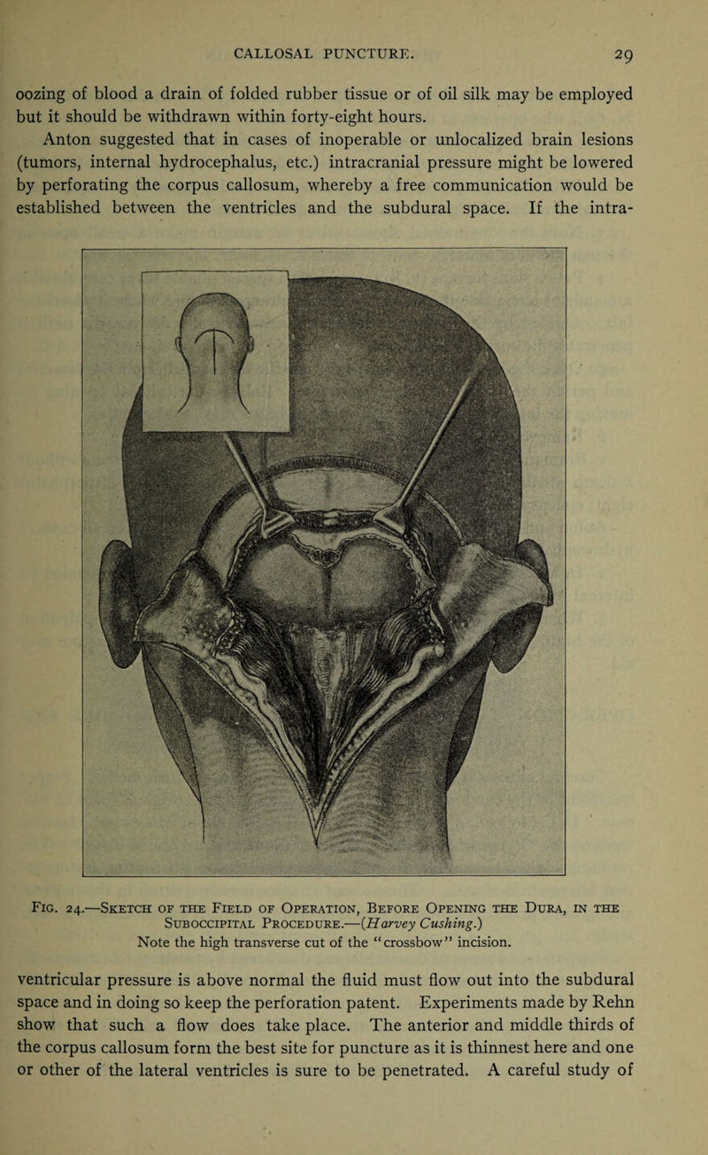 oozing of blood a drain of folded rubber tissue or of oil silk may be employed but it should be withdrawn within forty-eight hours. Anton suggested that in cases of inoperable or unlocalized brain lesions (tumors, internal hydrocephalus, etc.) intracranial pressure might be lowered by perforating the corpus callosum, whereby a free communication would be established between the ventricles and the subdural space. If the intra- Fig. 24.—Sketch of the Field of Operation, Before Opening the Dura, in the Suboccipital Procedure.—(Harvey Cushing.) Note the high transverse cut of the “crossbow” incision. ventricular pressure is above normal the fluid must flow out into the subdural space and in doing so keep the perforation patent. Experiments made by Rehn show that such a flow does take place. The anterior and middle thirds of the corpus callosum form the best site for puncture as it is thinnest here and one or other of the lateral ventricles is sure to be penetrated. A careful study of