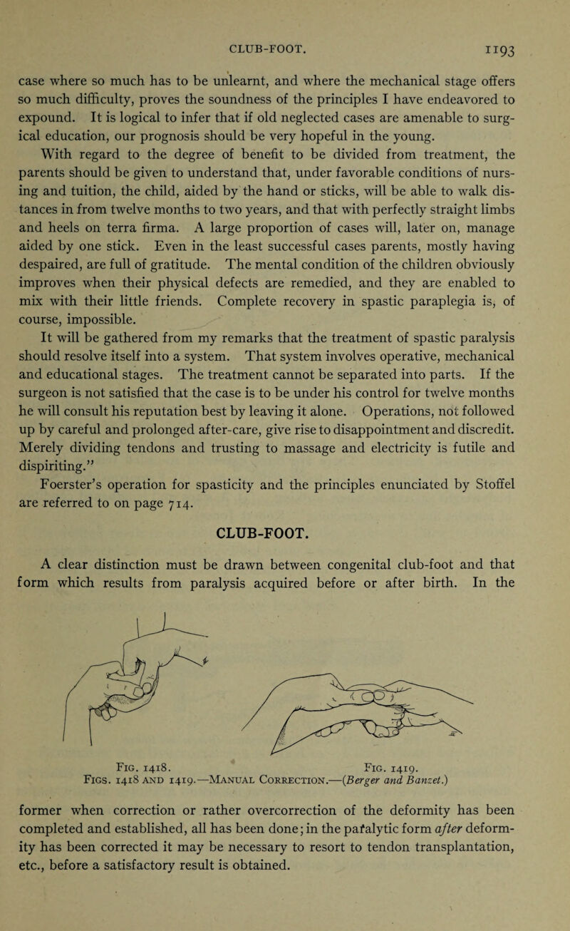 case where so much has to be unlearnt, and where the mechanical stage offers so much difficulty, proves the soundness of the principles I have endeavored to expound. It is logical to infer that if old neglected cases are amenable to surg¬ ical education, our prognosis should be very hopeful in the young. With regard to the degree of benefit to be divided from treatment, the parents should be given to understand that, under favorable conditions of nurs¬ ing and tuition, the child, aided by the hand or sticks, will be able to walk dis¬ tances in from twelve months to two years, and that with perfectly straight limbs and heels on terra firma. A large proportion of cases will, later on, manage aided by one stick. Even in the least successful cases parents, mostly having despaired, are full of gratitude. The mental condition of the children obviously improves when their physical defects are remedied, and they are enabled to mix with their little friends. Complete recovery in spastic paraplegia is, of course, impossible. It will be gathered from my remarks that the treatment of spastic paralysis should resolve itself into a system. That system involves operative, mechanical and educational stages. The treatment cannot be separated into parts. If the surgeon is not satisfied that the case is to be under his control for twelve months he will consult his reputation best by leaving it alone. Operations, not followed up by careful and prolonged after-care, give rise to disappointment and discredit. Merely dividing tendons and trusting to massage and electricity is futile and dispiriting.” Foerster’s operation for spasticity and the principles enunciated by Stoffel are referred to on page 714. CLUB-FOOT. A clear distinction must be drawn between congenital club-foot and that form which results from paralysis acquired before or after birth. In the Figs. 1418 and 1419.—Manual Correction.—{Berger and Banzet) former when correction or rather overcorrection of the deformity has been completed and established, all has been done; in the pafalytic form after deform¬ ity has been corrected it may be necessary to resort to tendon transplantation, etc., before a satisfactory result is obtained.