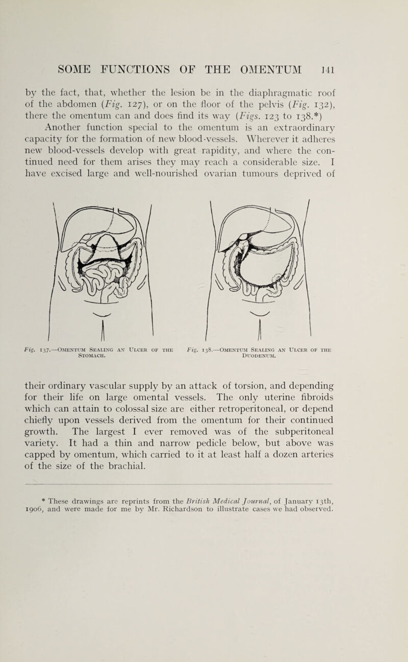 by the fact, that, whether the lesion be in the diaphragmatic roof of the abdomen (Fig. 127), or on the floor of the pelvis (Fig. 132), there the omentum can and does find its way (Figs. 123 to 138.*) Another function special to the omentum is an extraordinary capacity for the formation of new blood-vessels. Wherever it adheres new blood-vessels develop with great rapidity, and where the con¬ tinued need for them arises they may reach a considerable size. I have excised large and well-nourished ovarian tumours deprived of their ordinary vascular supply by an attack of torsion, and depending for their life on large omental vessels. The only uterine fibroids which can attain to colossal size are either retroperitoneal, or depend chiefly upon vessels derived from the omentum for their continued growth. The largest I ever removed was of the subperitoneal variety. It had a thin and narrow pedicle below, but above was capped by omentum, which carried to it at least half a dozen arteries of the size of the brachial. * These drawings are reprints from the British Medical Journal, of January 13th, 1906, and were made for me by Mr. Richardson to illustrate cases we had observed.