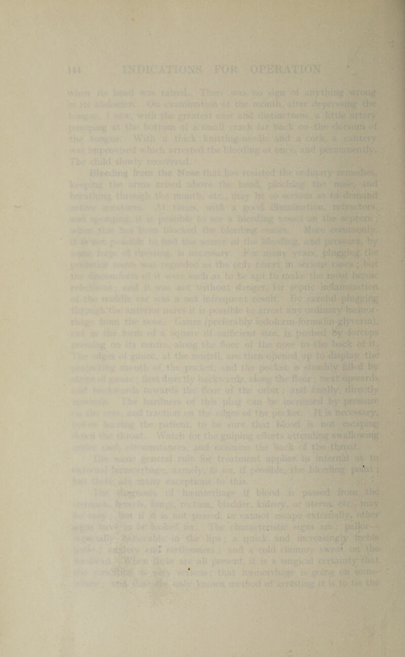 . . ■ • h throat. . ■ . ■ *