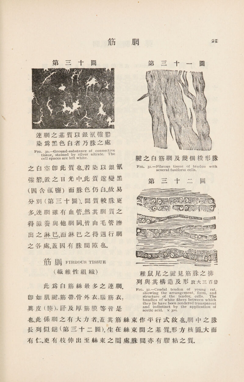 筋 211 第三十圖 連網之基質以銀氰強礬 染爲黑色白者乃脒之處 :Fig。30-—Ground-substance of connective tissue, stained by silver nitrate. The cell spaces are left white. 之白空卽此質也8若染以銀氰 強礬，置之日光中•此質遂變黑 (因含氯鹽）而脒色仍白•故易 分別（:第三十圖).間質較脒更 灸連網雖有血管.然其網質之 得滋養與他網同！由毛管滲 出之而淋巴之得週行胴 之各處•蓋因有脉間隙也《 筋腦 FIBROUS TISSUE (纖維性組織） 此爲白筋絲最多之連網. 卽如肌腱，筋帶.骨外衣，腦筋衣， 第三十一圖 腱之白筋胴及幾個梭形脒 Fig. 31.—Fibrous tissue of tendon with several fusiform cells. 第三十二圖 稚鼠尾之踺見筋脒之排 列與其構造及形放大三百倍 Fig. 32-一Caudal tendon of young rat， showing the arrangement, form, and structure of the tendon cells. The bundles of white fibers between which they lie have been rendered transparent and indistinct by the application of acetic acid, x 300. 眞皮（膠)，肝及厚筋膜等皆是 也,此係網之有大力者,蓋其筋絲束作平行式故也.網中之脒 長列似鏈(第三十二圖).生在絲束間之基質a形方核圓.大而 有仁„更有枝伸出至絲束之間處麗間亦有膠粘之質.