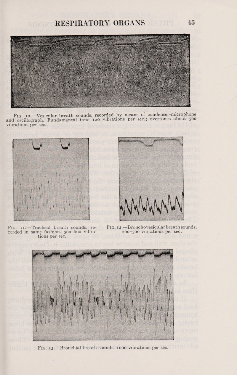 Fig. io.—Vesicular breath sounds, recorded by means of condenser-microphone and oscillograph. Fundamental tone 120 vibrations per sec.; overtones about 500 vibrations per sec. < U V ~' I • ' 1 l ; • . • <■ , ‘ ' M ' , ; ■■■'}.' 1 ‘ i ’ Fig. 11.—Tracheal breath sounds, re¬ corded in same fashion. 500-600 vibra¬ tions per sec. Fig. 12.—Bronchovesicular breath sounds. 200-500 vibrations per sec. Fig. 13.—Bronchial breath sounds. 1000 vibrations per sec.