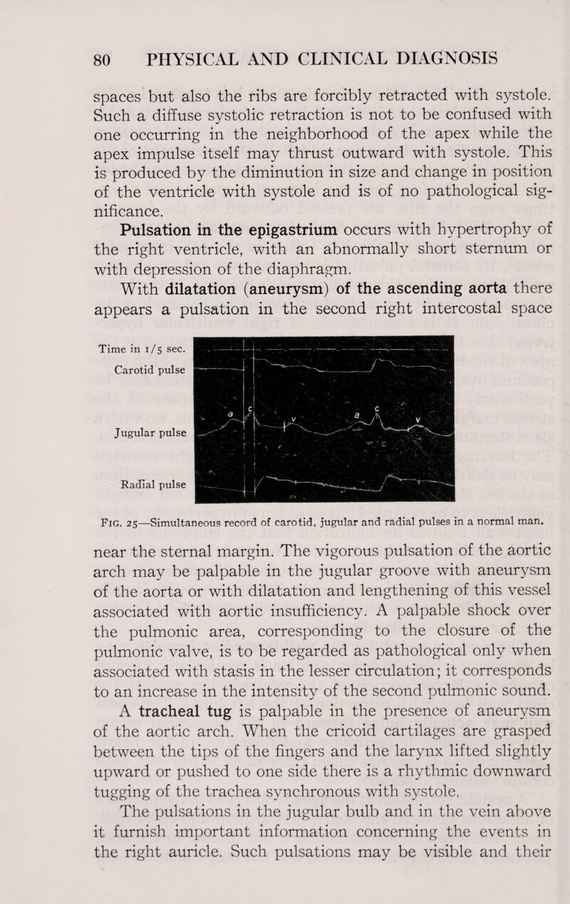 spaces but also the ribs are forcibly retracted with systole. Such a diffuse systolic retraction is not to be confused with one occurring in the neighborhood of the apex while the apex impulse itself may thrust outward with systole. This is produced by the diminution in size and change in position of the ventricle with systole and is of no pathological sig¬ nificance. Pulsation in the epigastrium occurs with hypertrophy of the right ventricle, with an abnormally short sternum or with depression of the diaphragm. With dilatation (aneurysm) of the ascending aorta there appears a pulsation in the second right intercostal space Time in 1/5 sec. Carotid pulse Jugular pulse Radial pulse Fig. 25—Simultaneous record of carotid, jugular and radial pulses in a normal man. near the sternal margin. The vigorous pulsation of the aortic arch may be palpable in the jugular groove with aneurysm of the aorta or with dilatation and lengthening of this vessel associated with aortic insufficiency. A palpable shock over the pulmonic area, corresponding to the closure of the pulmonic valve, is to be regarded as pathological only when associated with stasis in the lesser circulation; it corresponds to an increase in the intensity of the second pulmonic sound. A tracheal tug is palpable in the presence of aneurysm of the aortic arch. When the cricoid cartilages are grasped between the tips of the fingers and the larynx lifted slightly upward or pushed to one side there is a rhythmic downward tugging of the trachea synchronous with systole. The pulsations in the jugular bulb and in the vein above it furnish important information concerning the events in the right auricle. Such pulsations may be visible and their