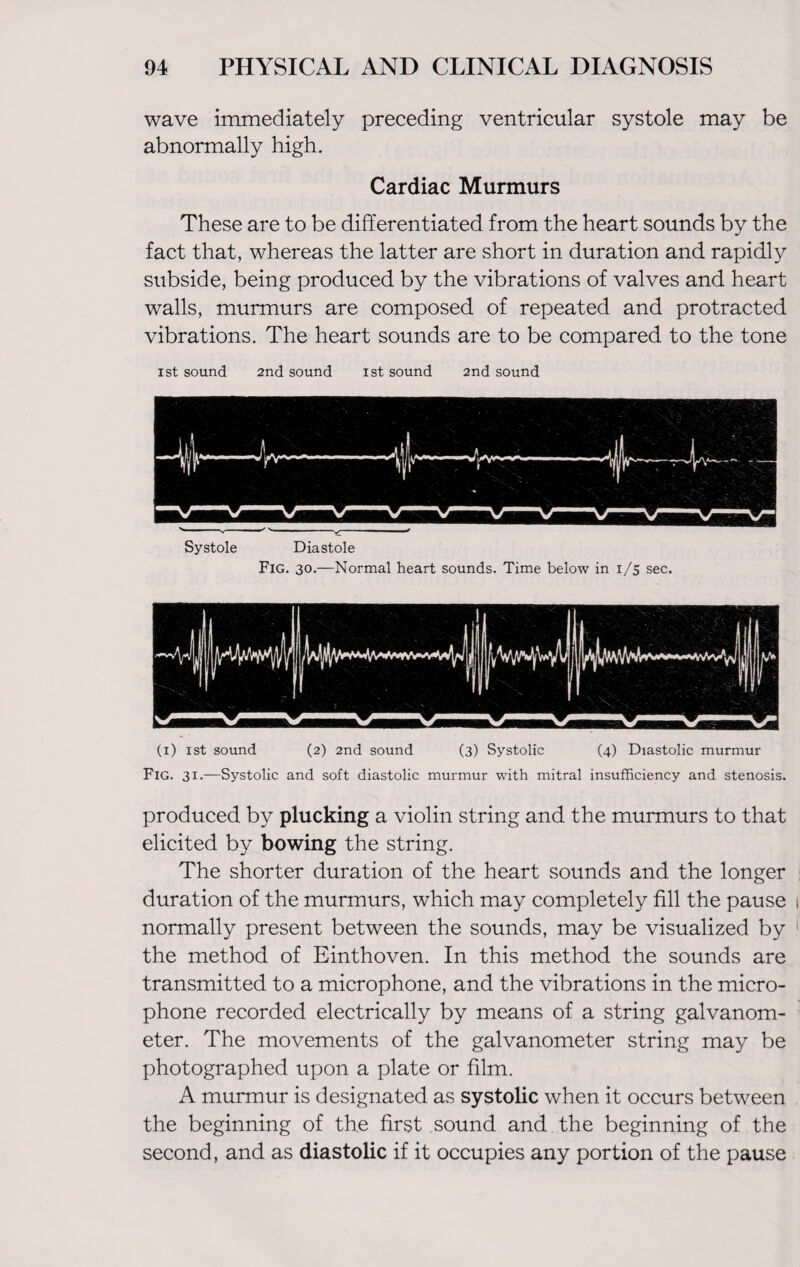 wave immediately preceding ventricular systole may be abnormally high. Cardiac Murmurs These are to be differentiated from the heart sounds by the fact that, whereas the latter are short in duration and rapidly subside, being produced by the vibrations of valves and heart walls, murmurs are composed of repeated and protracted vibrations. The heart sounds are to be compared to the tone ist sound 2nd sound ist sound 2nd sound Systole Diastole Fig. 30.—Normal heart sounds. Time below in 1/5 sec. (1) ist sound (2) 2nd sound (3) Systolic (4) Diastolic murmur Fig. 31.—Systolic and soft diastolic murmur with mitral insufficiency and stenosis. produced by plucking a violin string and the murmurs to that elicited by bowing the string. The shorter duration of the heart sounds and the longer duration of the murmurs, which may completely fill the pause i normally present between the sounds, may be visualized by 1 the method of Einthoven. In this method the sounds are transmitted to a microphone, and the vibrations in the micro¬ phone recorded electrically by means of a string galvanom¬ eter. The movements of the galvanometer string may be photographed upon a plate or film. A murmur is designated as systolic when it occurs between the beginning of the first sound and the beginning of the second, and as diastolic if it occupies any portion of the pause