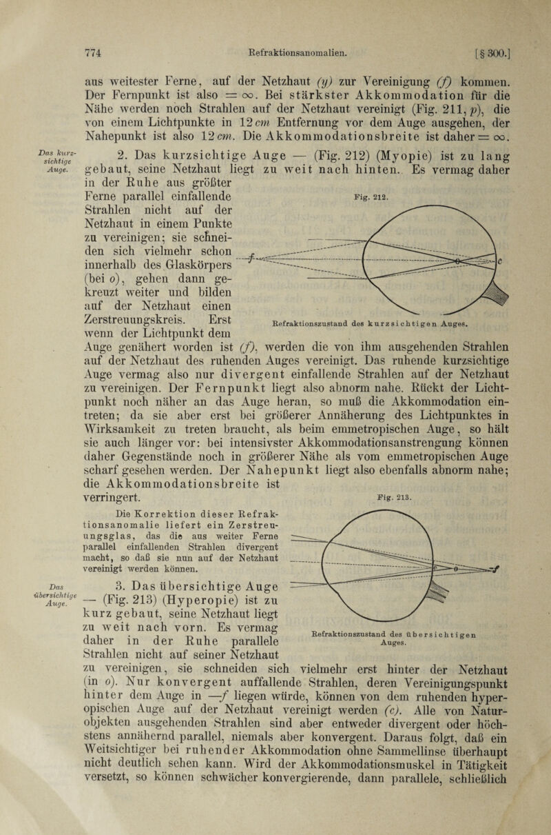 aus weitester Ferne, auf der Netzhaut (y) zur Vereinigung (f) kommen. Der Fernpunkt ist also = oo. Bei stärkster Akkommodation für die Nähe werden noch Strahlen auf der Netzhaut vereinigt (Fig. 211, p\ die von einem Lichtpunkte in 12 cm Entfernung vor dem Auge ausgehen, der Nahepunkt ist also 12cm. Die Akkommodationsbreite ist daher = oo. Das kurz¬ sichtige Auge. 2. Das kurzsichtige Auge — (Fig. 212) (Myopie) ist zu lang gebaut, seine Netzhaut liegt zu weit nach hinten. Es vermag daher in der Ruhe aus größter Ferne parallel einfallende Fig. 212. Strahlen nicht auf der Netzhaut in einem Punkte zu vereinigen; sie schnei¬ den sich vielmehr schon innerhalb des Glaskörpers (bei 0), gehen dann ge¬ kreuzt weiter und bilden auf der Netzhaut einen Zerstreuungskreis. Erst wenn der Lichtpunkt dem Auge genähert worden ist (f). werden die von ihm ausgehenden Strahlen auf der Netzhaut des ruhenden Auges vereinigt. Das ruhende kurzsichtige Auge vermag also nur divergent einfallende Strahlen auf der Netzhaut zu vereinigen. Der Fernpunkt liegt also abnorm nahe. Rückt der Licht¬ punkt noch näher an das Auge heran, so muß die Akkommodation ein- treten; da sie aber erst bei größerer Annäherung des Lichtpunktes in Wirksamkeit zu treten braucht, als beim emmetropischen Auge, so hält sie auch länger vor: bei intensivster Akkommodationsanstrengung können daher Gegenstände noch in größerer Nähe als vom emmetropischen Auge scharf gesehen werden. Der Nahepunkt liegt also ebenfalls abnorm nahe; die Akkommodationsbreite ist verringert. Fig. 213. Die Korrektion dieser Refrak¬ tionsanomalie liefert ein Zerstreu¬ ungsglas, das die aus weiter Ferne parallel einfallenden Strahlen divergent macht, so daß sie nun auf der Netzhaut vereinigt werden können. Das 3. Das übersichtige Auge - (Fig. 213) (Hyperopie) ist zu kurz gebaut, seine Netzhaut liegt zu weit nach vorn. Es vermag daher in der Ruhe parallele Strahlen nicht auf seiner Netzhaut zu vereinigen, sie schneiden sich vielmehr erst hinter der Netzhaut (in 0). Nur konvergent auffallende Strahlen, deren Vereinigungspunkt hinter dem Auge in —-f liegen würde, können von dem ruhenden hyper- opischen Auge auf der Netzhaut vereinigt werden (c). Alle von Natur¬ objekten ausgehenden Strahlen sind aber entweder divergent oder höch¬ stens annähernd parallel, niemals aber konvergent. Daraus folgt, daß ein Weitsichtiger bei ruhender Akkommodation ohne Sammellinse überhaupt nicht deutlich sehen kann. Wird der Akkommodationsmuskel in Tätigkeit versetzt, so können schwächer konvergierende, dann parallele, schließlich Kefraktionszustand des übersichtigen Auges.