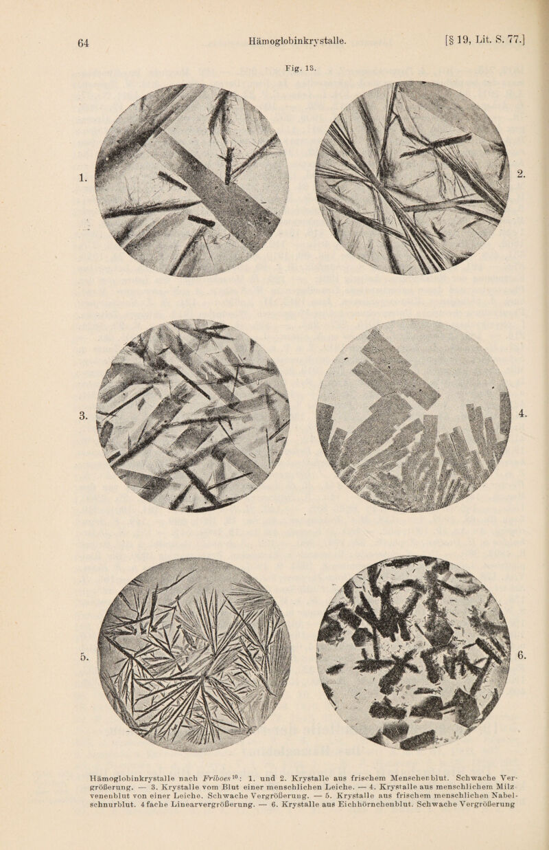 Hämoglobinkrystalle nach Friboes'^^: 1. und 2. Krystalle aus frischem Menschenblut. Schwache Ver- venenblut von einer Leiche. Schwache Vergrößerung. — 5. Krystalle a,us frischem menschlichen Nabel¬ schnurblut. 4fache Linearvergrößerung.— 6. Krystalle aus Eichhörnchenblut. Schwache Vergrößerung Fig.13.