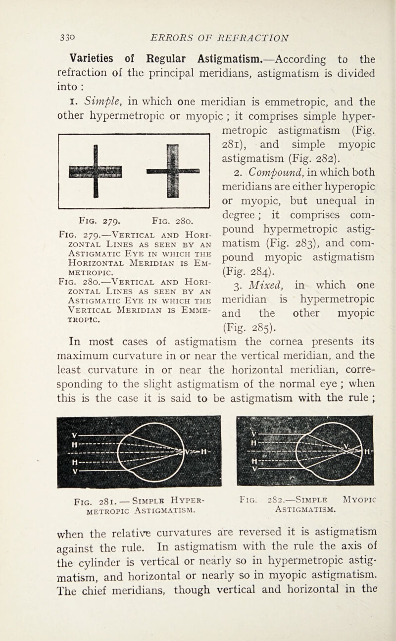 Varieties of Regular Astigmatism.—According to the refraction of the principal meridians, astigmatism is divided into : i. Simple, in which one meridian is emmetropic, and the other hypermetropic or myopic ; it comprises simple hyper¬ metropic astigmatism (Fig. 281), and simple myopic astigmatism (Fig. 282). 2. Compound, in which both meridians are either hyperopic or myopic, but unequal in degree; it comprises com¬ pound hypermetropic astig¬ matism (Fig. 283), and com¬ pound myopic astigmatism (Fig. 284). 3. Mixed, in which one meridian is hypermetropic and the other myopic (Fig. 285). In most cases of astigmatism the cornea presents its maximum curvature in or near the vertical meridian, and the least curvature in or near the horizontal meridian, corre¬ sponding to the slight astigmatism of the normal eye ; when this is the case it is said to be astigmatism with the rule ; Fig. 279. Fig. 280. Fig. 279.—Vertical and Hori¬ zontal Lines as seen by an Astigmatic Eye in which the Horizontal Meridian is Em¬ metropic. Fig. 280.—Vertical and Hori¬ zontal Lines as seen by an Astigmatic Eye in which the Vertical Meridian is Emme¬ tropic. Fig. 281. — Simple Hyper¬ metropic Astigmatism. Fig. 2S2.—Simple Myopic Astigmatism. when the relative curvatures are reversed it is astigmatism against the rule. In astigmatism with the rule the axis of the cylinder is vertical or nearly so in hypermetropic astig¬ matism, and horizontal or nearly so in myopic astigmatism. The chief meridians, though vertical and horizontal in the