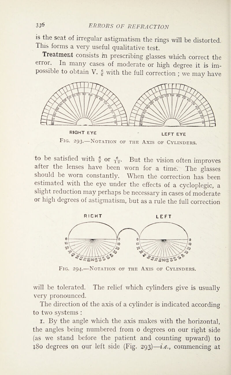 is the seat of irregular astigmatism the rings will be distorted. This forms a very useful qualitative test. Treatment consists rn prescribing glasses which correct the error. In many cases of moderate or high degree it is im¬ possible to obtain V. E with the full correction ; we may have to be satisfied with ~ or yk. But the vision often improves after the lenses have been worn for a time. The glasses should be worn constantly. When the correction has been estimated with the eye under the effects of a cycloplegic, a slight i eduction may perhaps be necessary in cases of moderate 01 high degrees of astigmatism, but as a rule the full correction RICHT LEFT will be tolerated. The relief which cylinders give is usually very pronounced. The direction of the axis of a cylinder is indicated according to two systems : I. By the angle which the axis makes with the horizontal, the angles being numbered from o degrees on our right side (as we stand before the patient and counting upward) to iSo degrees qn qur left side (Fig. 293)—i.e., cqmmencing at