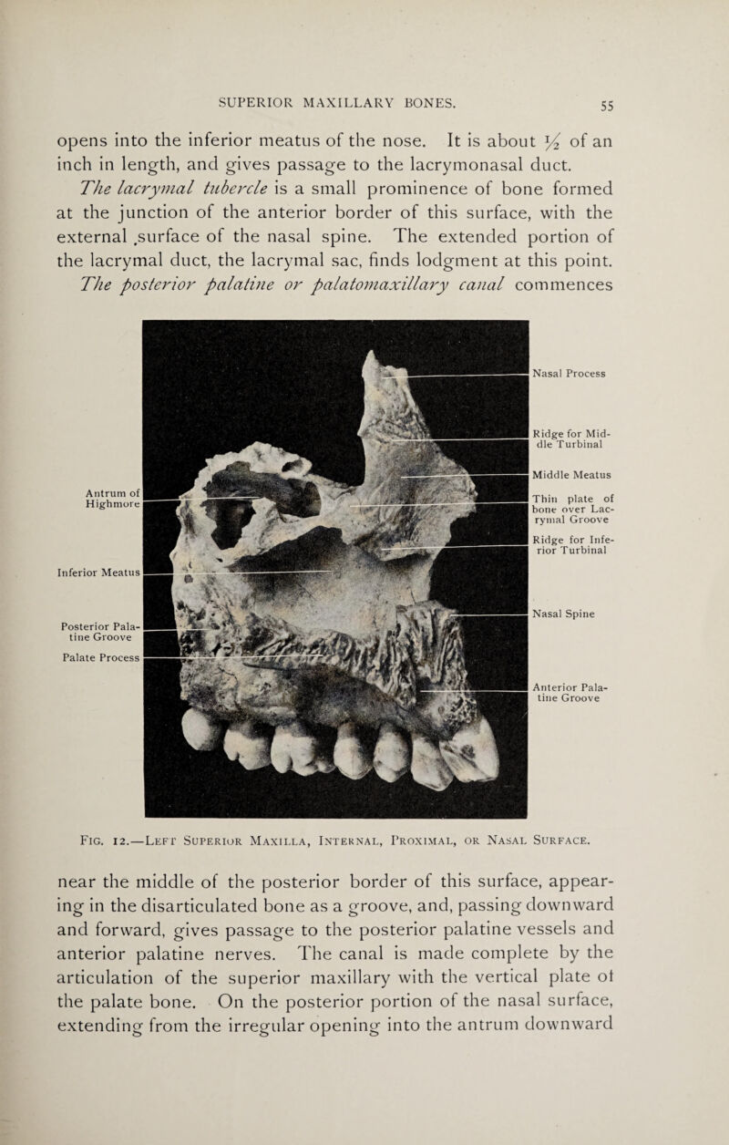 opens into the inferior meatus of the nose. It is about Y2 of an inch in length, and gives passage to the lacrymonasal duct. The lacrymal tubercle is a small prominence of bone formed at the junction of the anterior border of this surface, with the external .surface of the nasal spine. The extended portion of the lacrymal duct, the lacrymal sac, finds lodgment at this point. The posterior palatine or palatomaxillary canal commences Antrum of Highmore Inferior Meatus Posterior Pala¬ tine Groove Palate Process Nasal Process Ridge for Mid¬ dle T urbinal Middle Meatus Thin plate of bone over Lac¬ rymal Groove Ridge for Infe¬ rior Turbinal Nasal Spine Anterior Pala¬ tine Groove Fig. 12.—Left Superior Maxilla, Internal, Proximal, or Nasal Surface. near the middle of the posterior border of this surface, appear¬ ing in the disarticulated bone as a groove, and, passing downward and forward, gives passage to the posterior palatine vessels and anterior palatine nerves. The canal is made complete by the ardculation of the superior maxillary with the vertical plate ot the palate bone. On the posterior portion of the nasal surface, extending from the irregular opening into the antrum downward