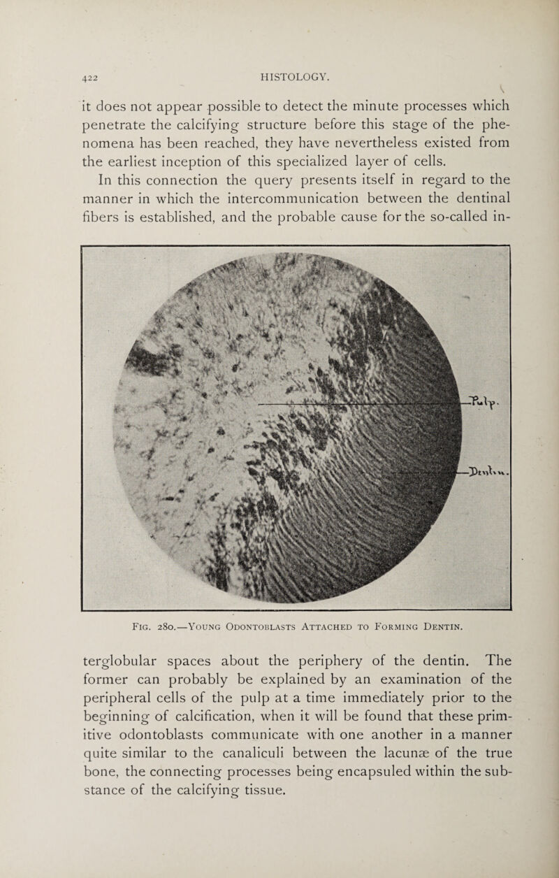 it does not appear possible to detect the minute processes which penetrate the calcifying structure before this stage of the phe¬ nomena has been reached, they have nevertheless existed from the earliest inception of this specialized layer of cells. In this connection the query presents itself in regard to the manner in which the intercommunication between the dentinal fibers is established, and the probable cause for the so-called in- Fig. 280.—Young Odontoblasts Attached to Forming Dentin. terglobular spaces about the periphery of the dentin. The former can probably be explained by an examination of the peripheral cells of the pulp at a time immediately prior to the beginning of calcification, when it will be found that these prim¬ itive odontoblasts communicate with one another in a manner quite similar to the canaliculi between the lacunae of the true bone, the connecting processes being encapsuled within the sub¬ stance of the calcifying tissue.