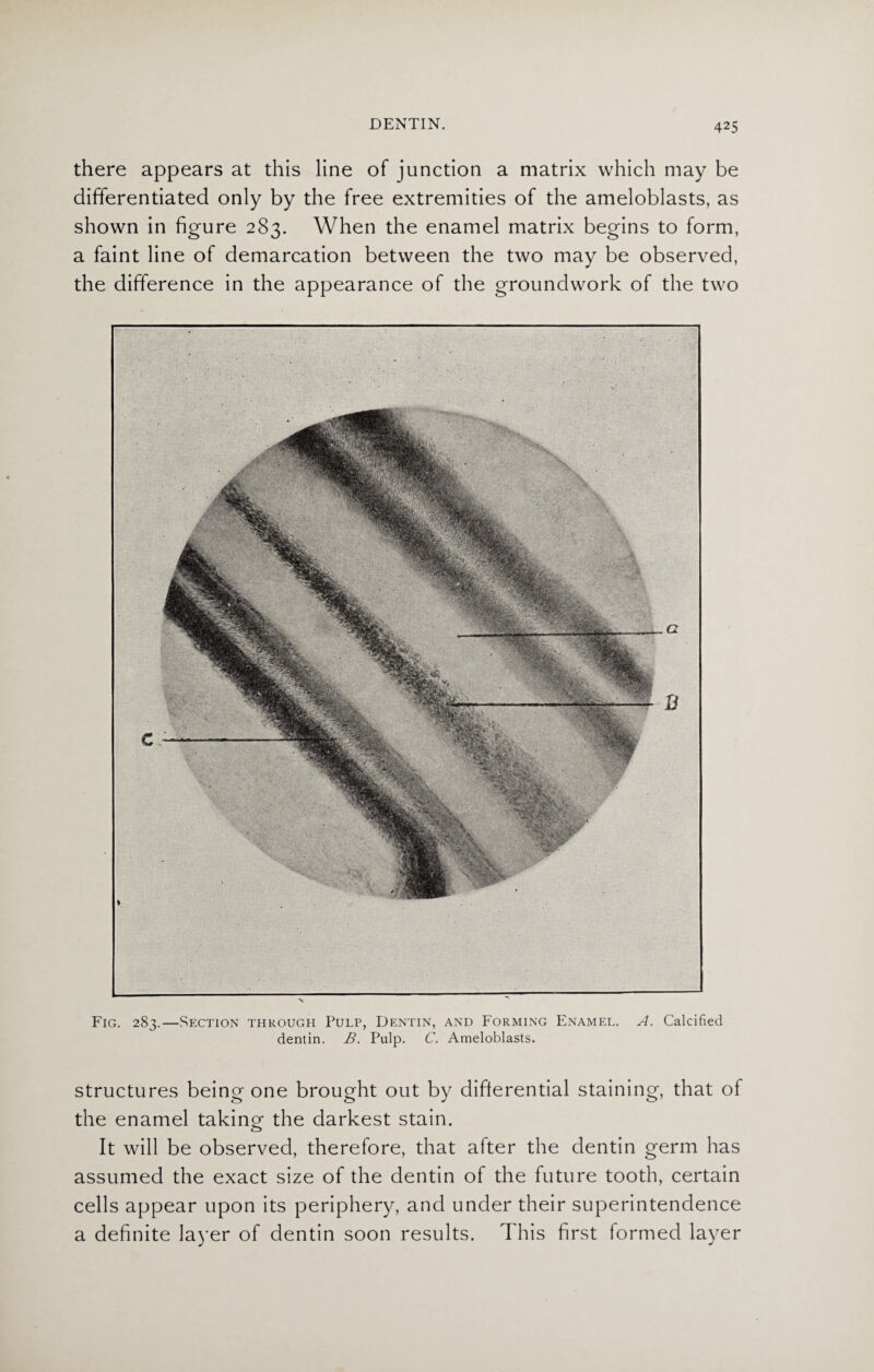there appears at this line of junction a matrix which may be differentiated only by the free extremities of the ameloblasts, as shown in figure 283. When the enamel matrix begins to form, a faint line of demarcation between the two may be observed, the difference in the appearance of the groundwork of the two Fig. 283.—Section through Pulp, Dentin, and Forming Enamel. A. Calcified dentin. B. Pulp. C. Ameloblasts. structures being one brought out by differential staining, that of the enamel taking the darkest stain. <A> It will be observed, therefore, that after the dentin germ has assumed the exact size of the dentin of the future tooth, certain cells appear upon its periphery, and under their superintendence a definite layer of dentin soon results. This first formed layer
