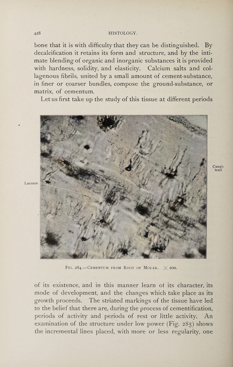 bone that it is with difficulty that they can be distinguished. By decalcification it retains its form and structure, and by the inti¬ mate blending of organic and inorganic substances it is provided with hardness, solidity, and elasticity. Calcium salts and col¬ lagenous fibrils, united by a small amount of cement-substance, in finer or coarser bundles, compose the ground-substance, or matrix, of cementum. Let us first take up the study of this tissue at different periods 4 Lacunae Canal iculi Fig. 284.—Cementum erom Root of Molar. X 2°°- of its existence, and in this manner learn oi its character, its mode of development, and the changes which take place as its growth proceeds. The striated markings of the tissue have led to the belief that there are, during the process of cementification, periods of activity and periods of rest or little activity. An examination of the structure under low power (Fig. 285) shows the incremental lines placed, with more or less regularity, one