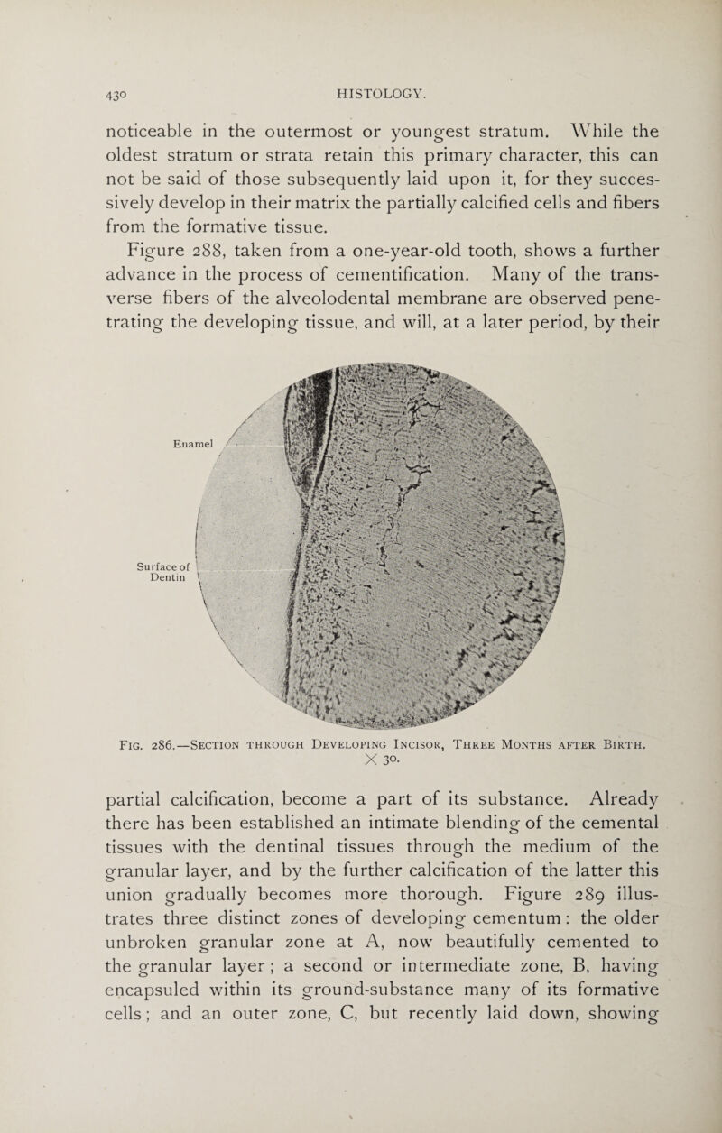 43° noticeable in the outermost or youngest stratum. While the oldest stratum or strata retain this primary character, this can not be said of those subsequently laid upon it, for they succes¬ sively develop in their matrix the partially calcified cells and fibers from the formative tissue. Figure 288, taken from a one-year-old tooth, shows a further advance in the process of cementification. Many of the trans¬ verse fibers of the alveolodental membrane are observed pene¬ trating the developing tissue, and will, at a later period, by their Surface of Dentin \ Fig. 286.—Section through Developing Incisor, Three Months after Birth. X 30- partial calcification, become a part of its substance. Already there has been established an intimate blending of the cemental tissues with the dentinal tissues through the medium of the granular layer, and by the further calcification of the latter this union gradually becomes more thorough. Figure 289 illus¬ trates three distinct zones of developing cementum : the older unbroken granular zone at A, now beautifully cemented to the granular layer; a second or intermediate zone, B, having encapsuled within its ground-substance many of its formative cells; and an outer zone, C, but recently laid down, showing