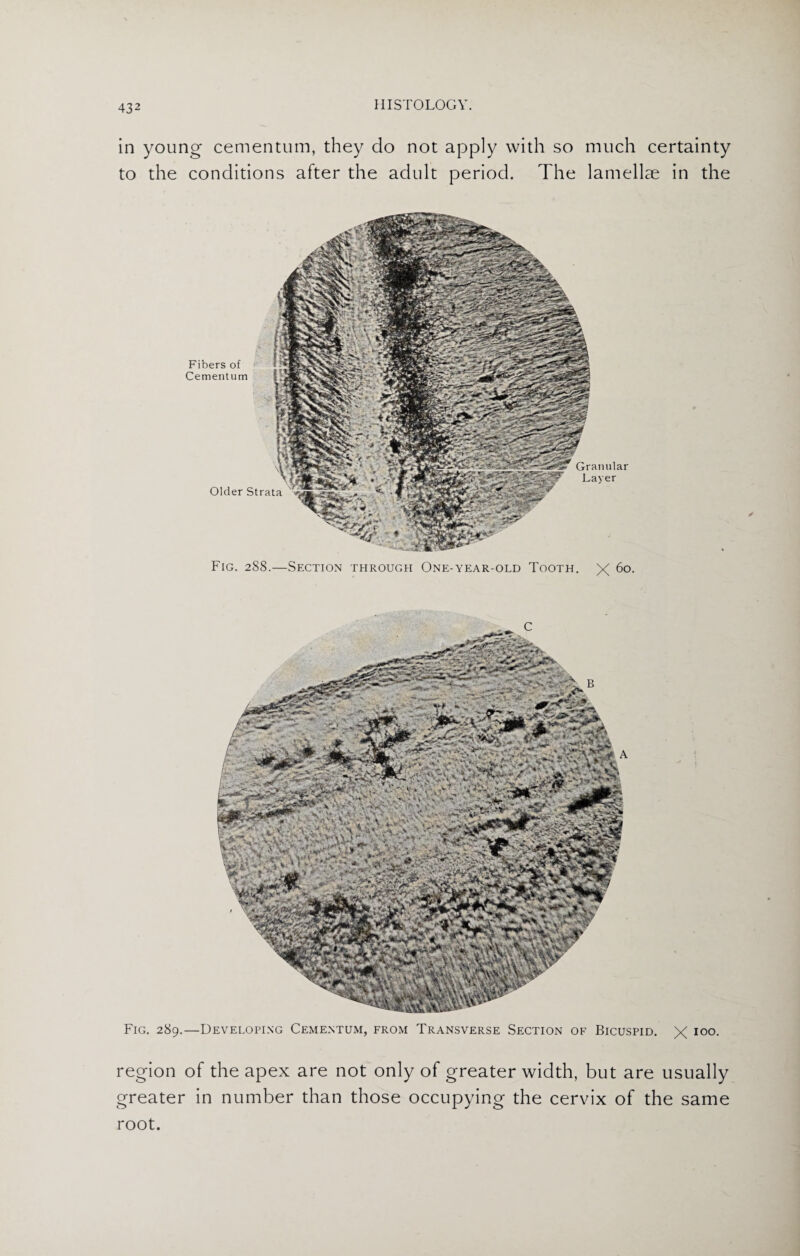 in young cementum, they do not apply with so much certainty to the conditions after the adult period. The lamellae in the Older Strata Granular Layer Fibers of Cementum Fig. 288.—Section through One-year-old Tooth. X 60. Fig. 289.—Developing Cementum, from Transverse Section of Bicuspid. X 100. region of the apex are not only of greater width, but are usually greater in number than those occupying the cervix of the same root.