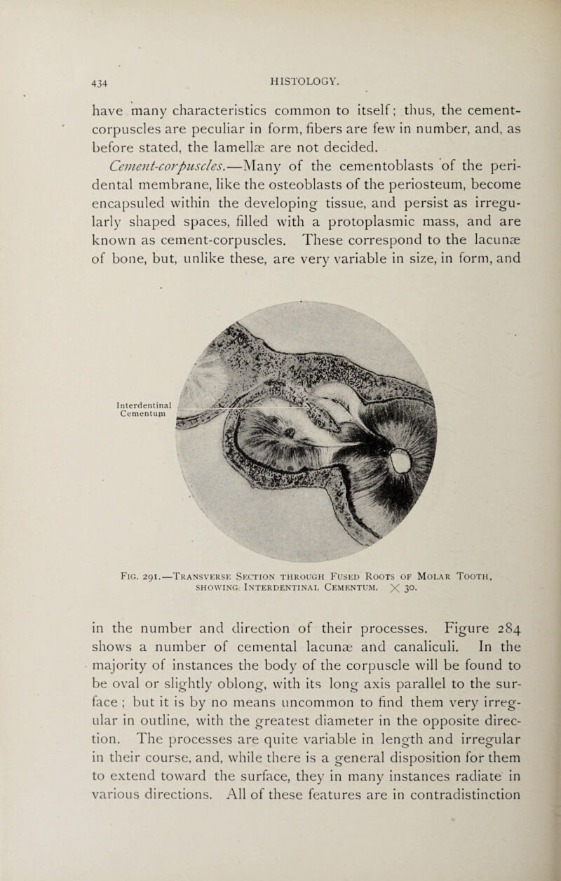 have many characteristics common to itself; thus, the cement- corpuscles are peculiar in form, fibers are few in number, and, as before stated, the lamellae are not decided. Cement-corpuscles.—Many of the cementoblasts of the peri¬ dental membrane, like the osteoblasts of the periosteum, become encapsuled within the developing tissue, and persist as irregu¬ larly shaped spaces, filled with a protoplasmic mass, and are known as cement-corpuscles. These correspond to the lacunae of bone, but, unlike these, are very variable in size, in form, and Interdentinal Cementum Fig. 291.—Transverse Section through Fused Roots of Molar Tooth, showing Interdentinal Cementum. X 3°- in the number and direction of their processes. Figure 284 shows a number of cemental lacunae and canaliculi. In the majority of instances the body of the corpuscle will be found to be oval or slightly oblong, with its long axis parallel to the sur¬ face ; but it is by no means uncommon to find them very irreg¬ ular in outline, with the greatest diameter in the opposite direc¬ tion. The processes are quite variable in length and irregular in their course, and, while there is a general disposition for them to extend toward the surface, they in many instances radiate in various directions. All of these features are in contradistinction