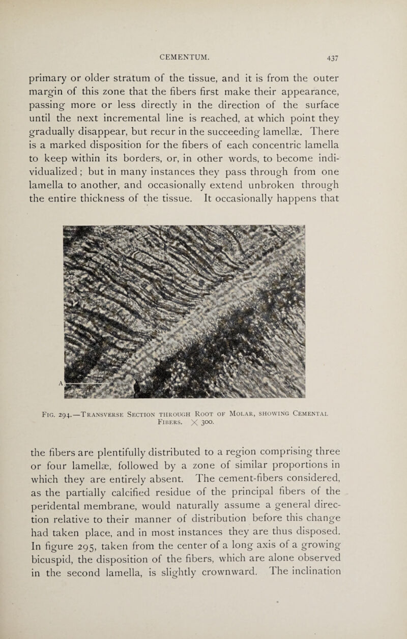 primary or older stratum of the tissue, and it is from the outer margin of this zone that the fibers first make their appearance, passing more or less directly in the direction of the surface until the next incremental line is reached, at which point they gradually disappear, but recur in the succeeding lamellae. There is a marked disposition for the fibers of each concentric lamella to keep within its borders, or, in other words, to become indi¬ vidualized ; but in many instances they pass through from one lamella to another, and occasionally extend unbroken through the entire thickness of the tissue. It occasionally happens that Fig. 294.—Transverse Section through Root of Molar, showing Cemental Fibers. X 3°°- the fibers are plentifully distributed to a region comprising three or four lamellae, followed by a zone of similar proportions in which they are entirely absent. The cement-fibers considered, as the partially calcified residue of the principal fibers of the peridental membrane, would naturally assume a general direc¬ tion relative to their manner of distribution before this change had taken place, and in most instances they are thus disposed. In figure 295, taken from the center of a long axis ol a growing bicuspid, the disposition of the fibers, which are alone observed in the second lamella, is slightly crownward. I he inclination