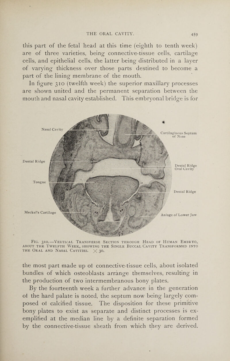 this part of the fetal head at this time (eighth to tenth week) are of three varieties, beine connective-tissue cells, cartilage o o cells, and epithelial cells, the latter being distributed in a layer of varying thickness over those parts destined to become a part of the lining membrane of the mouth. In figure 310 (twelfth week) the superior maxillary processes are shown united and the permanent separation between the mouth and nasal cavity established. This embryonal bridge is for Dental Ridge Dental Ridge Meckel’s Cartilage Anlage of Lower Jaw Cartilaginous Septum of Nose - Dental Ridge Oral Cavity Nasal Cavitv Fig. 310.—Vertical Transverse Section through Head of Human Embryo, about the Twelfth Week, showing the Single Buccal Cavity Transformed into the Oral and Nasal Cavities. X 3°- the most part made up ol connective-tissue cells, about isolated bundles of which osteoblasts arrange themselves, resulting in the production of two intermembranous bony plates. By the fourteenth week a further advance in the generation ol the hard palate is noted, the septum now being largely com¬ posed ol calcified tissue. The disposition for these primitive bony plates to exist as separate and distinct processes is ex¬ emplified at the median line by a definite separation formed by the connective-tissue sheath from which they are derived.