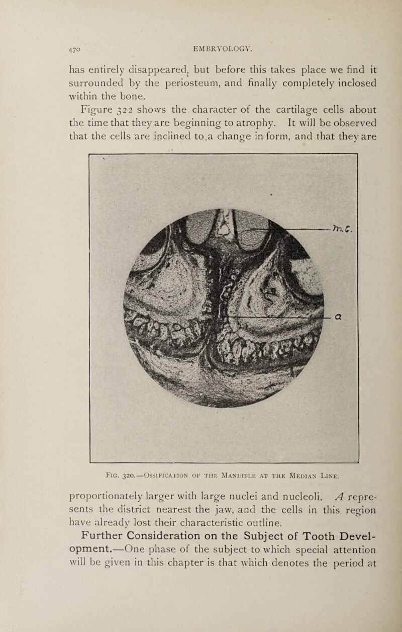 has entirely disappeared, but before this takes place we find it surrounded by the periosteum, and finally completely inclosed within the bone. Figure 322 shows the character of the cartilage cells about the time that they are beginning to atrophy. It will be observed that the cells are inclined to.a change in form, and that they are Fig. 320.—Ossification of the Mandible at the Median Line. proportionately larger with large nuclei and nucleoli. A repre¬ sents the district nearest the jaw, and the cells in this region have already lost their characteristic outline. Further Consideration on the Subject of Tooth Devel¬ opment.—One phase of the subject to which special attention will be given in this chapter is that which denotes the period at