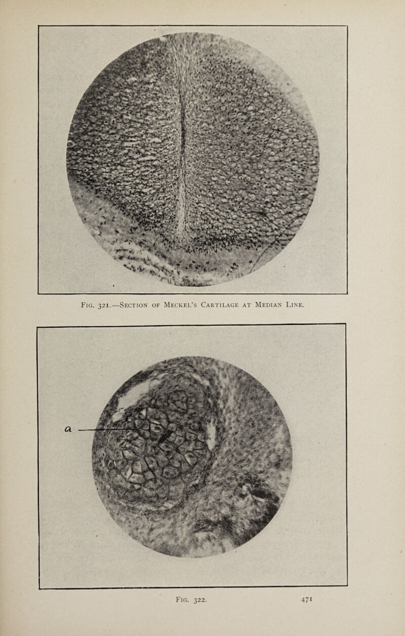 Fig. 321.—Section of Meckel’s Cartilage at Median Line. Fig. 322. 47i